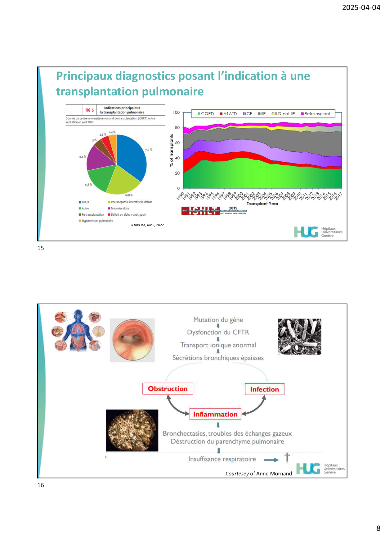 COURS TX PULMONAIRE dia étudiants page 8