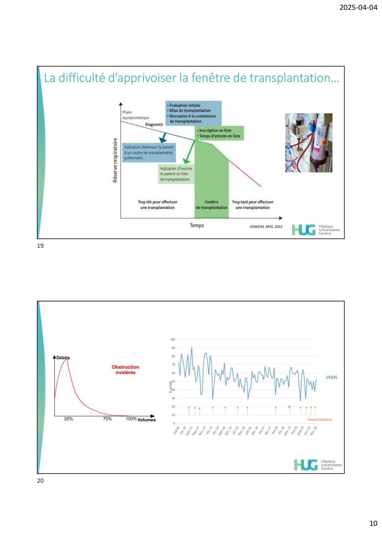 COURS TX PULMONAIRE dia étudiants page 10