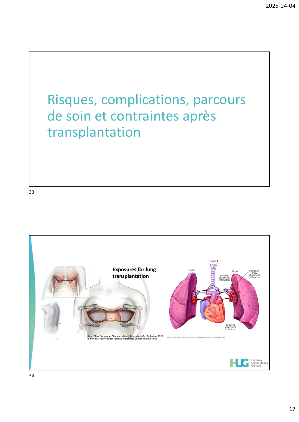 COURS TX PULMONAIRE dia étudiants page 17