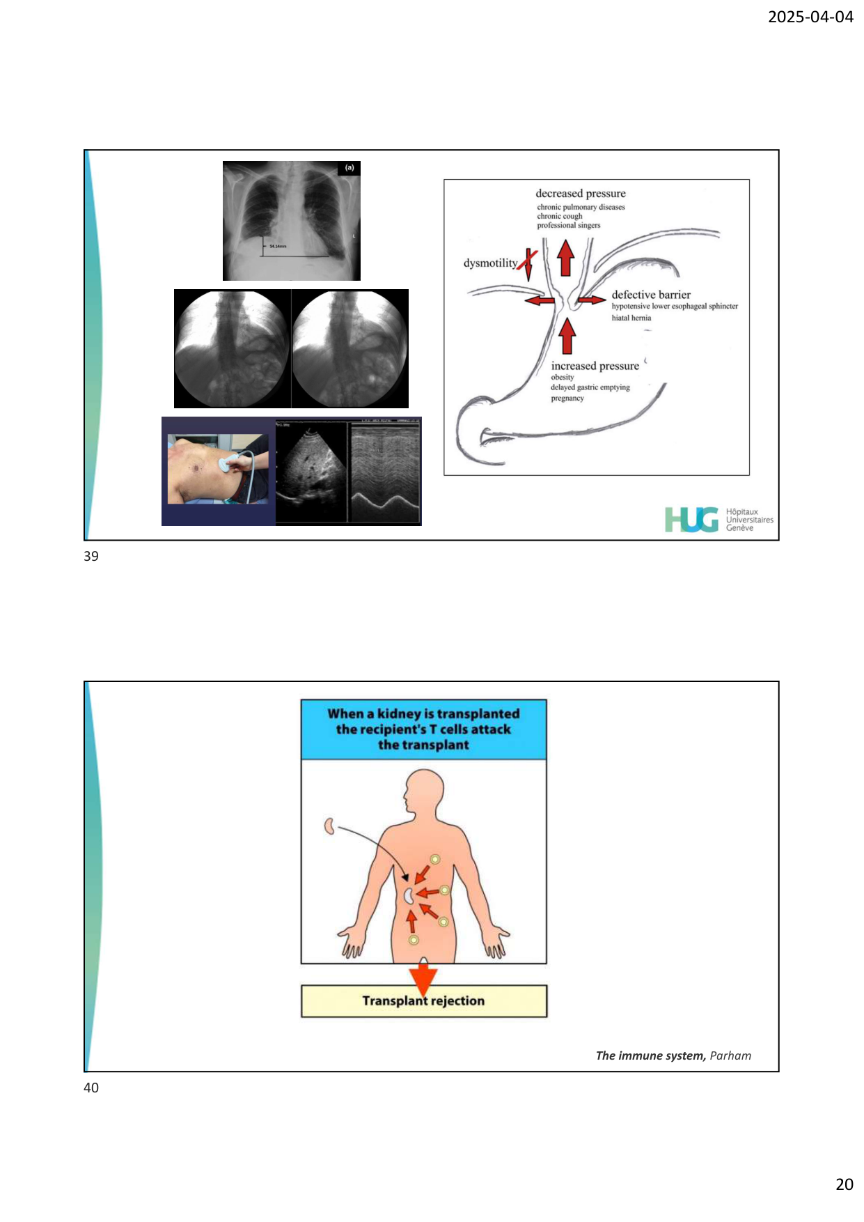 COURS TX PULMONAIRE dia étudiants page 20
