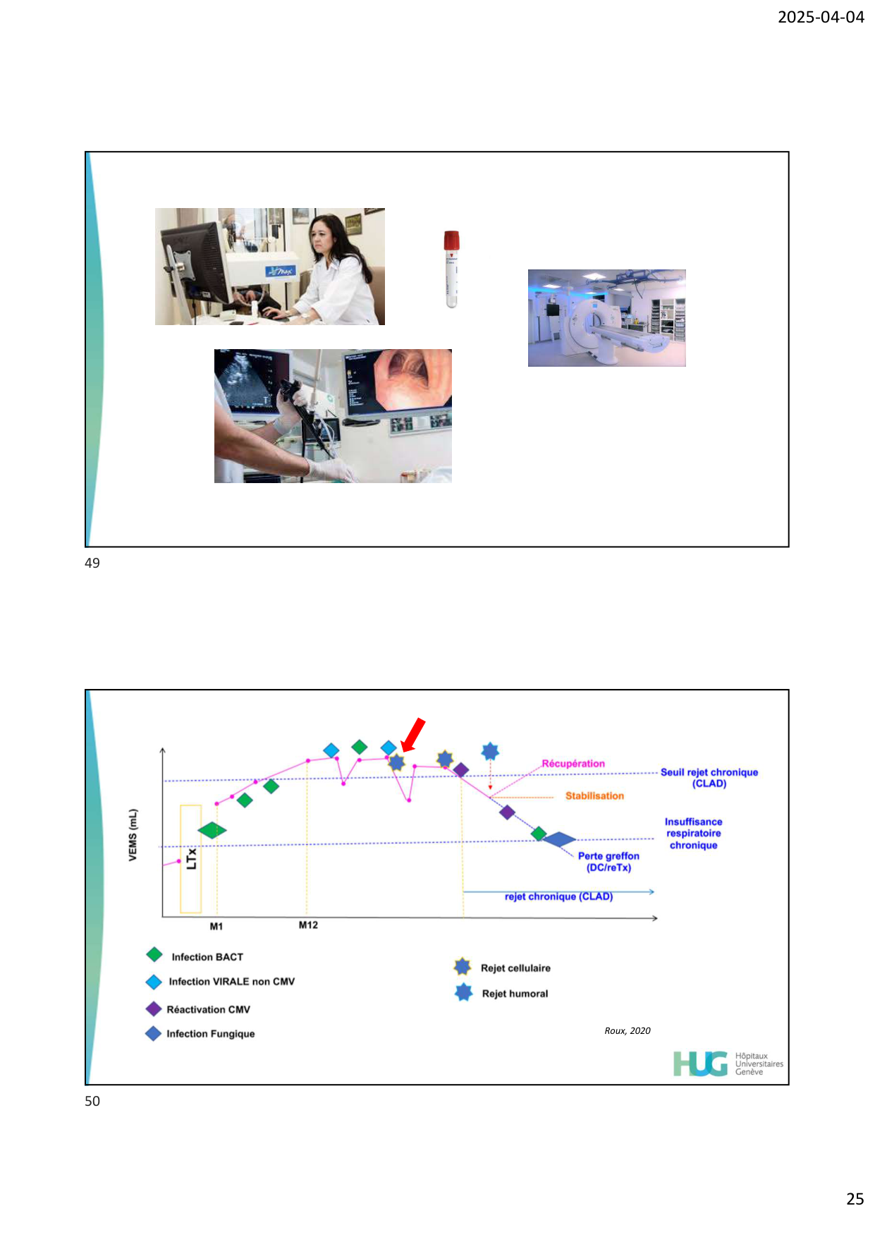 COURS TX PULMONAIRE dia étudiants page 25