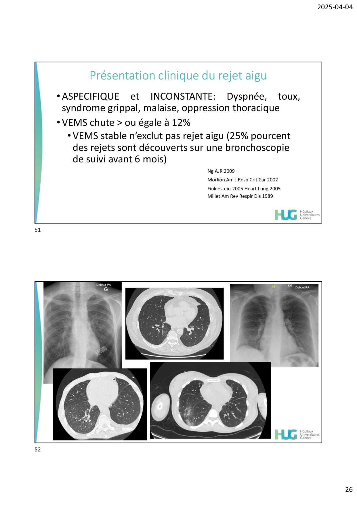 COURS TX PULMONAIRE dia étudiants page 26