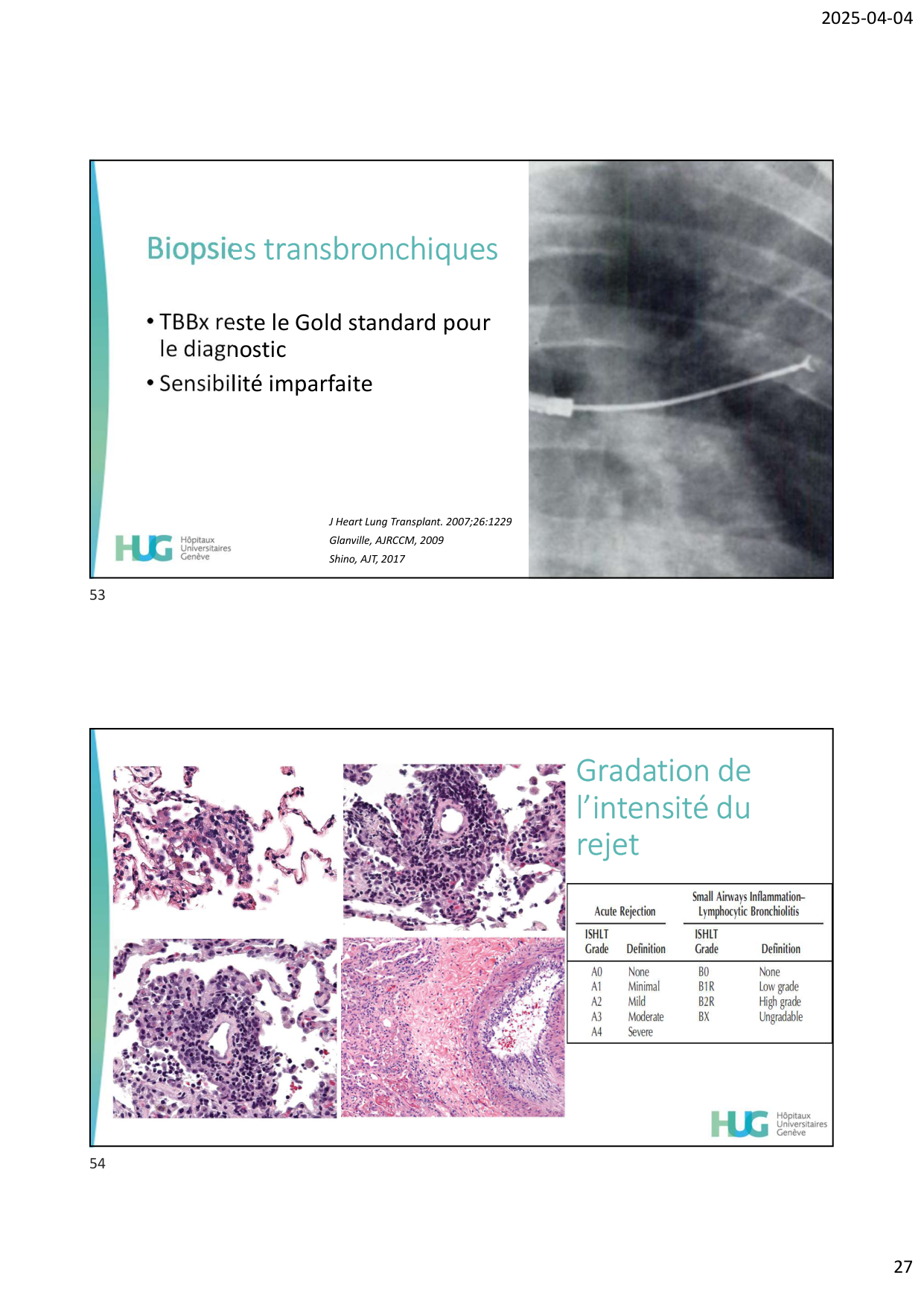 COURS TX PULMONAIRE dia étudiants page 27
