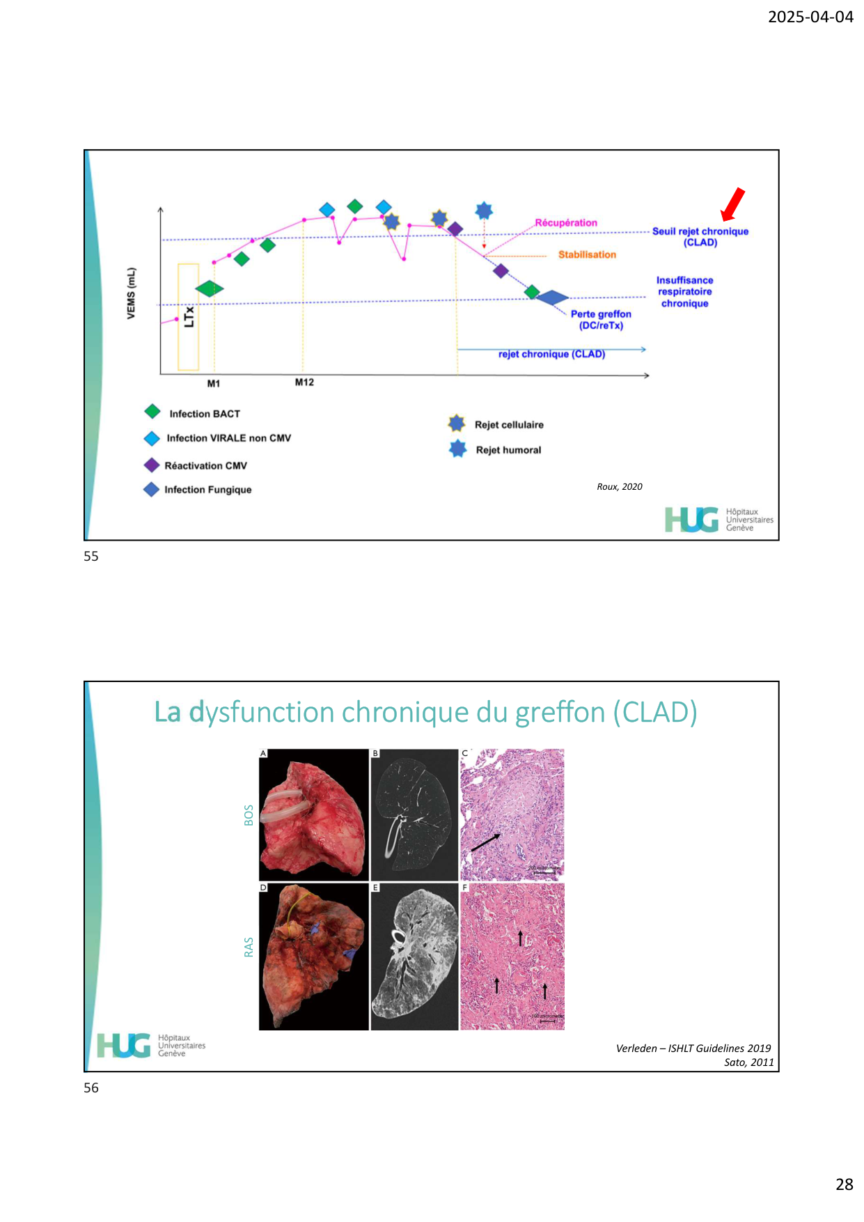 COURS TX PULMONAIRE dia étudiants page 28