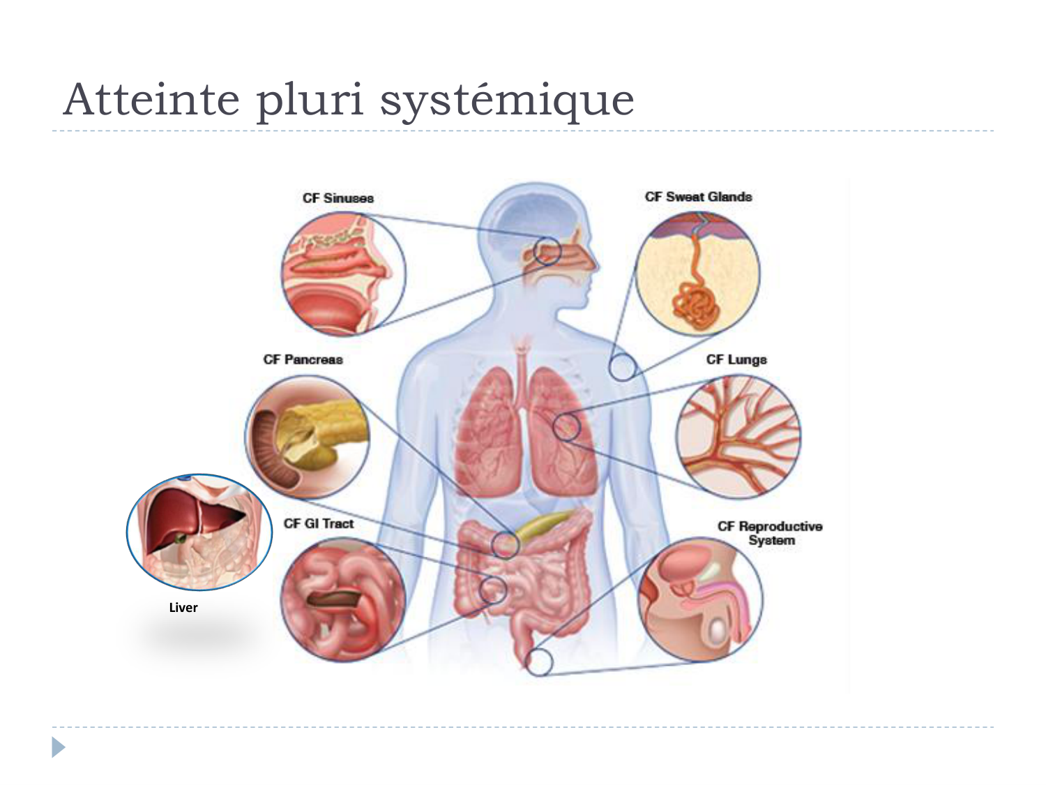 Cours Muco 6- atteinte pulm AMornand page 2