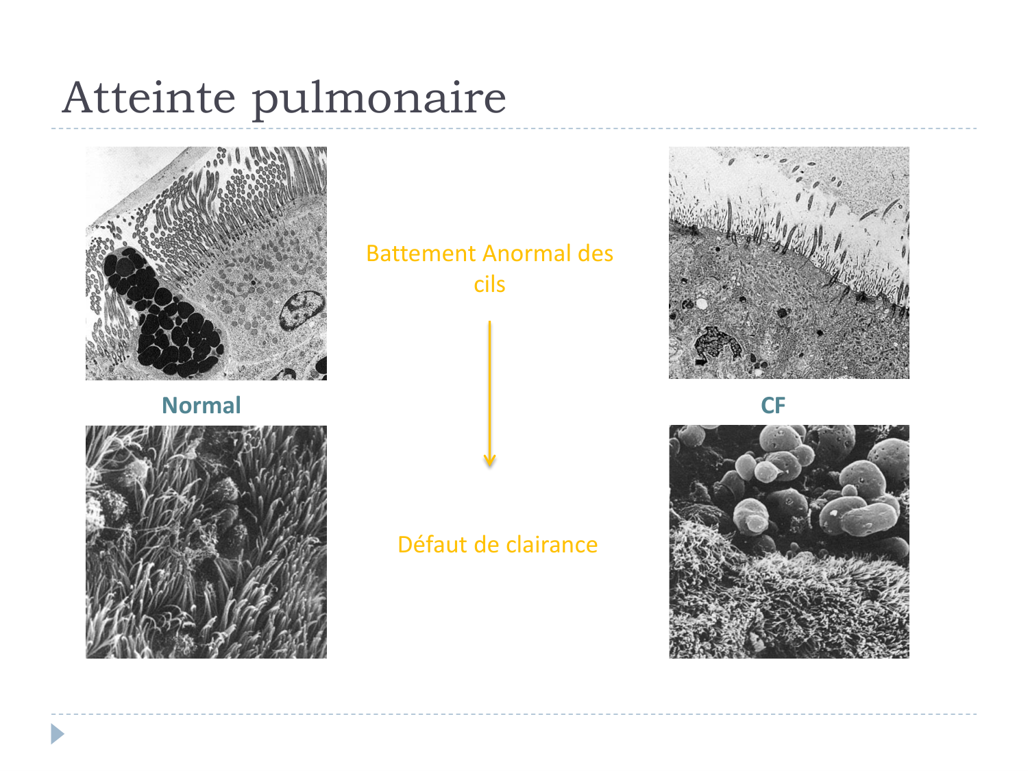 Cours Muco 6- atteinte pulm AMornand page 9