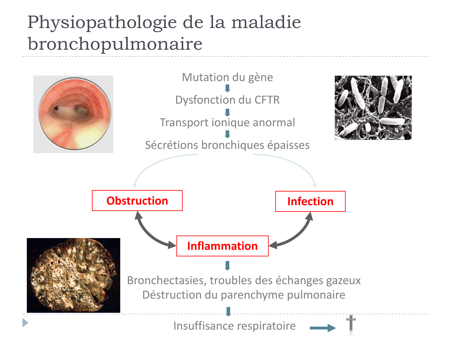 Cours Muco 6- atteinte pulm AMornand page 17