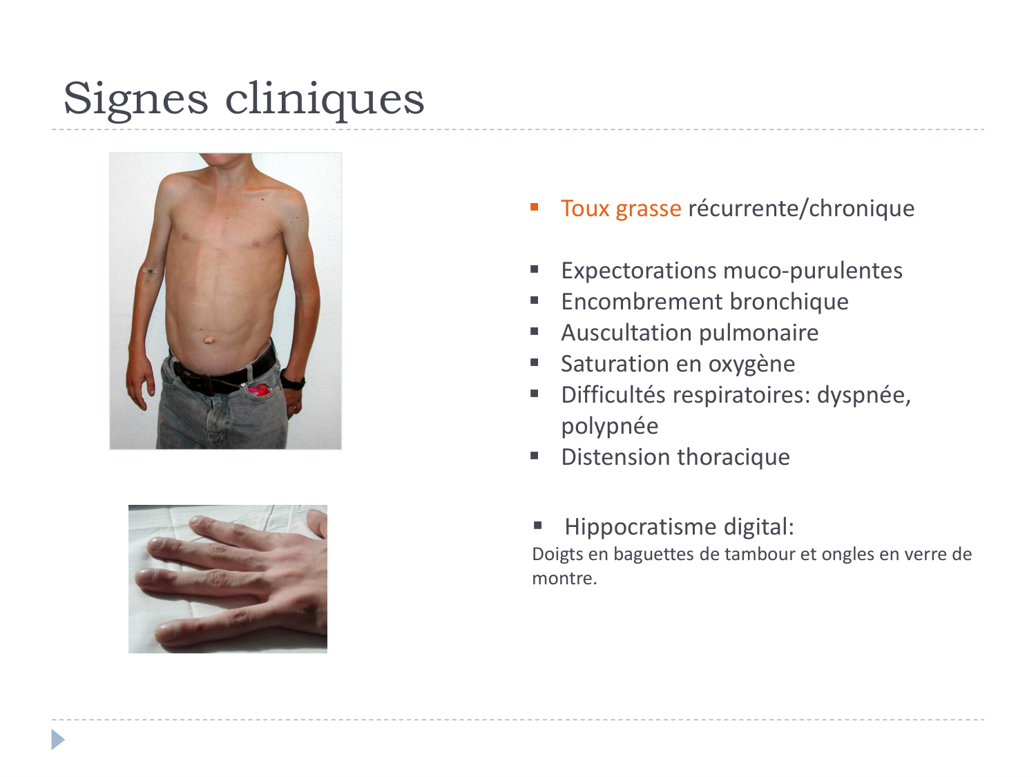 Cours Muco 6- atteinte pulm AMornand page 19