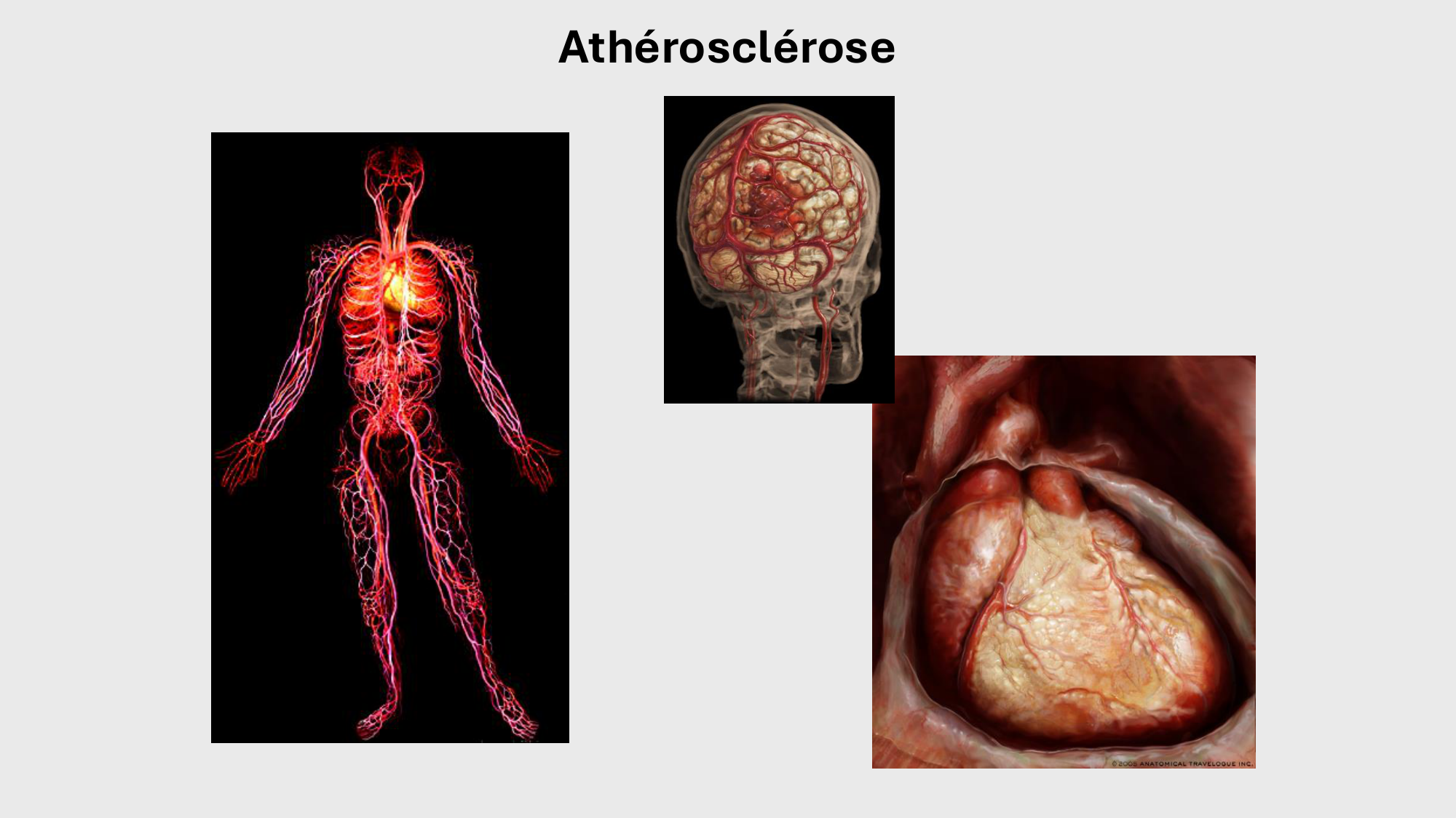 F-Mach-Cas de-liaison-Athero-1-2025 page 21