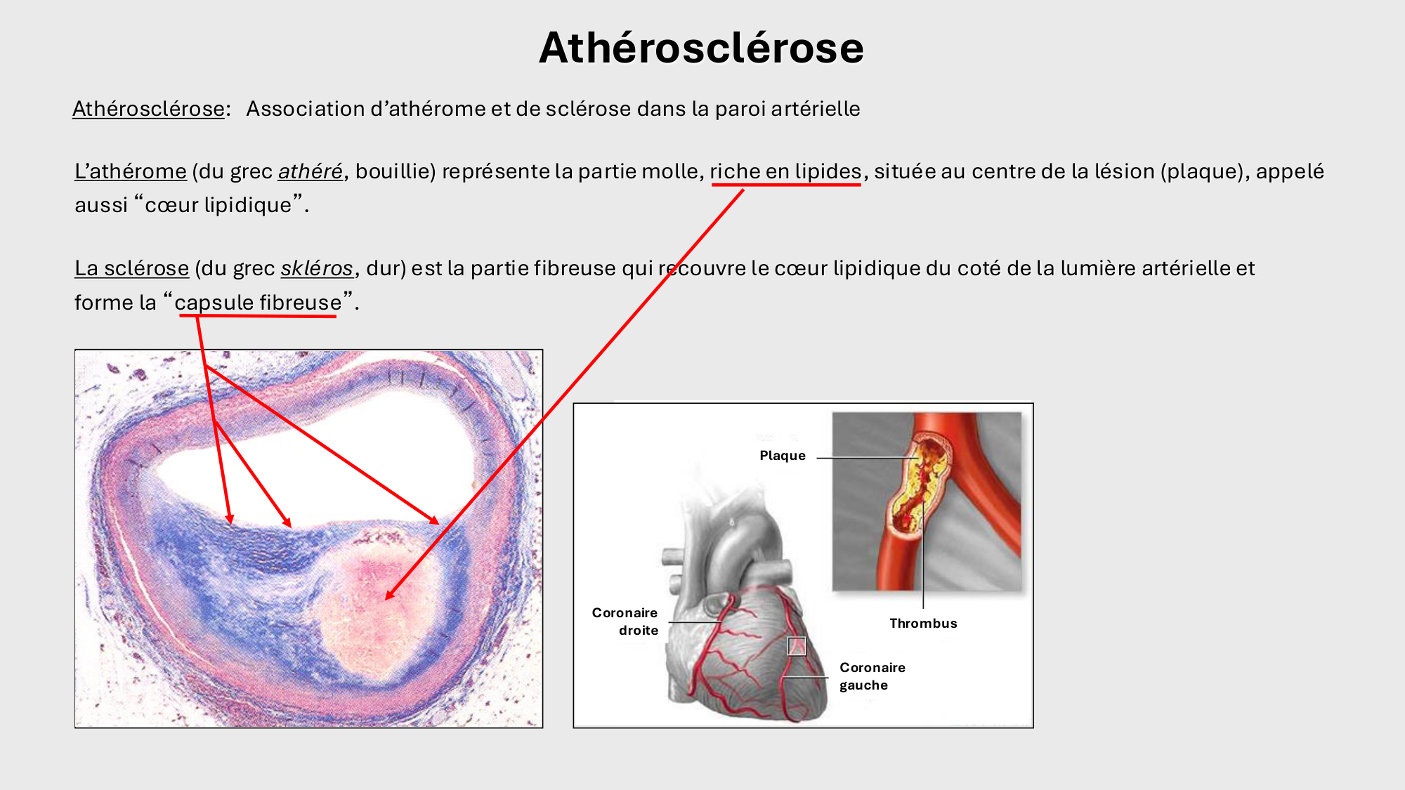 F-Mach-Cas de-liaison-Athero-1-2025 page 31