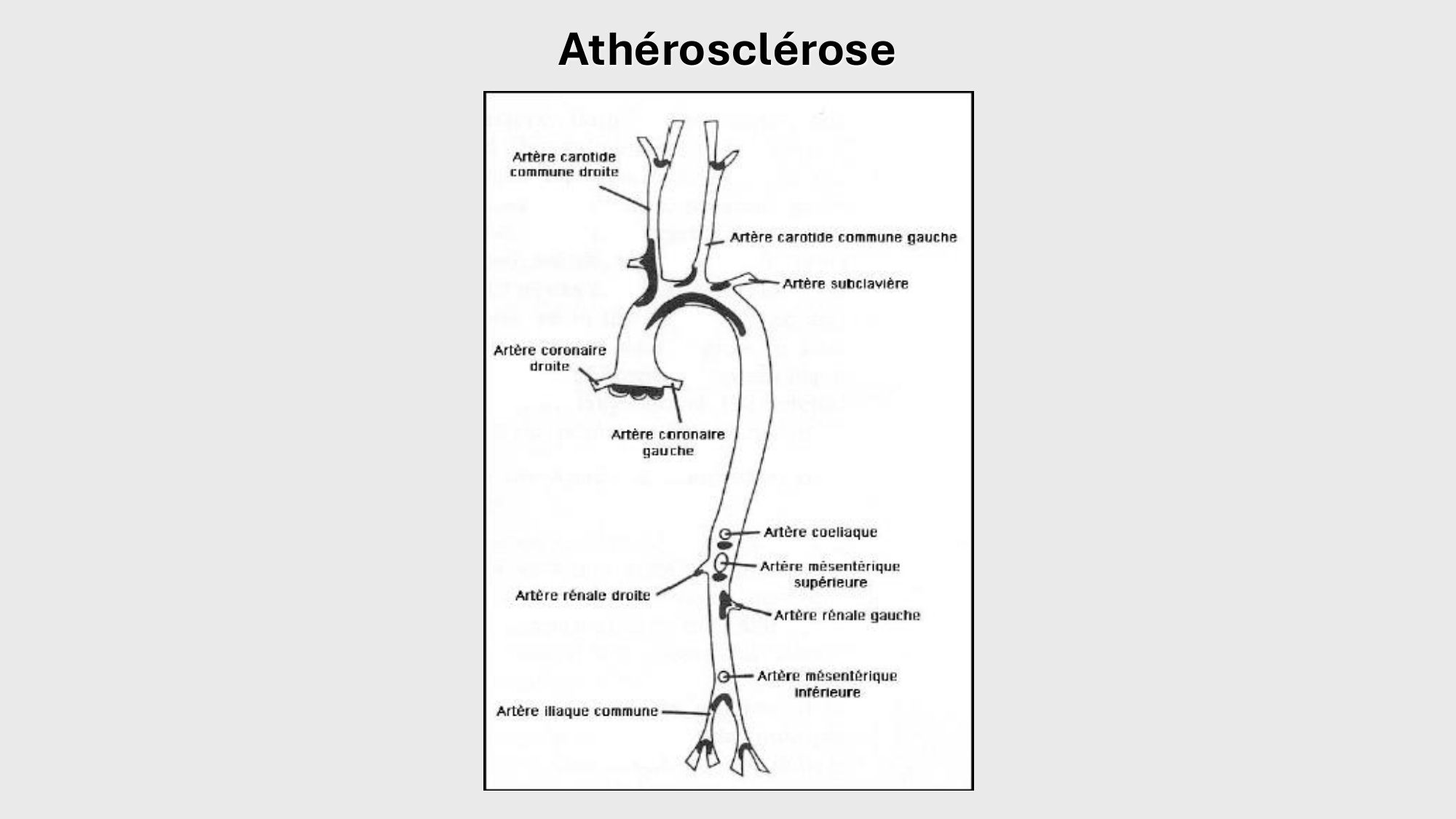 F-Mach-Cas de-liaison-Athero-1-2025 page 32