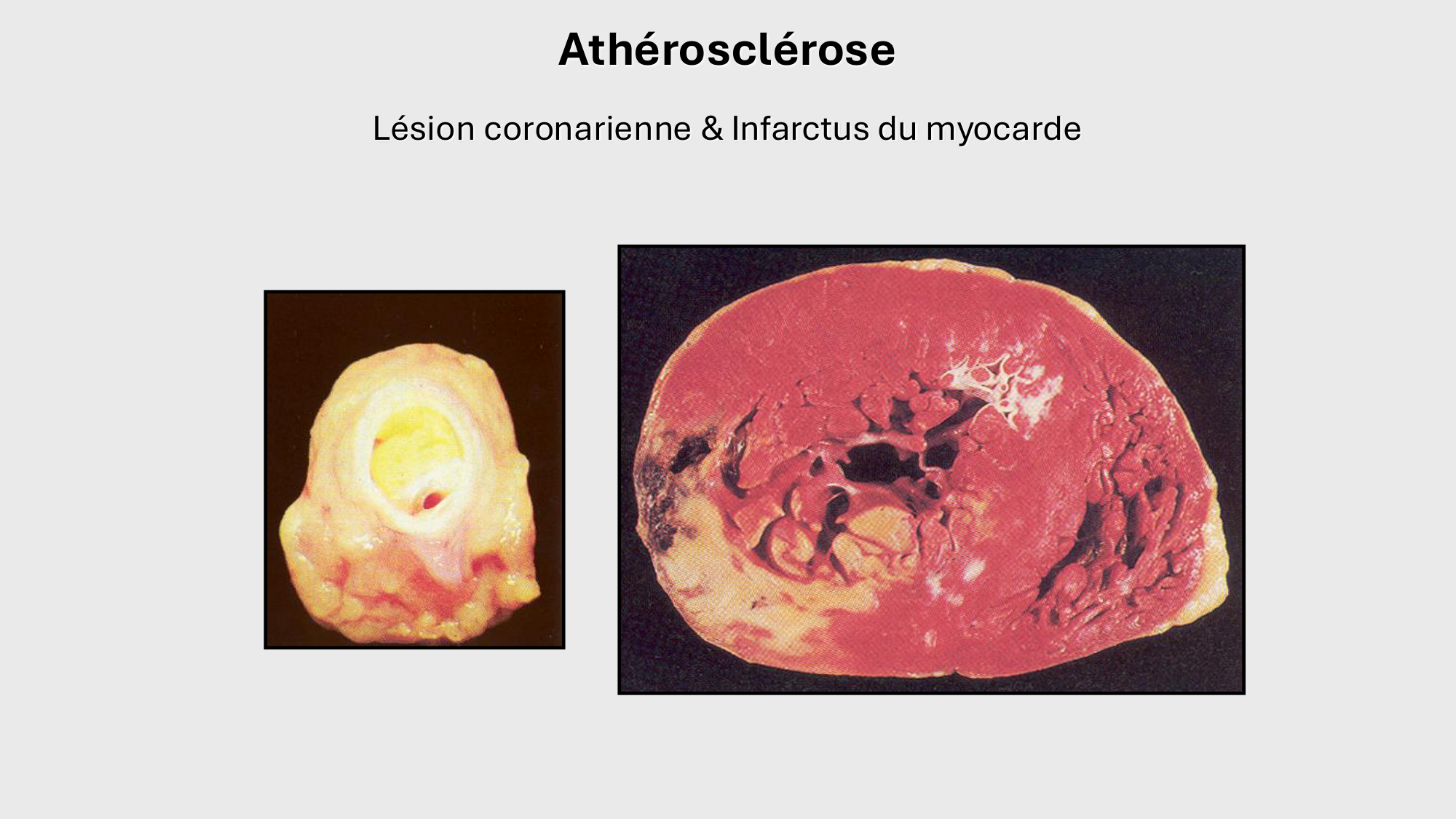 F-Mach-Cas de-liaison-Athero-1-2025 page 33