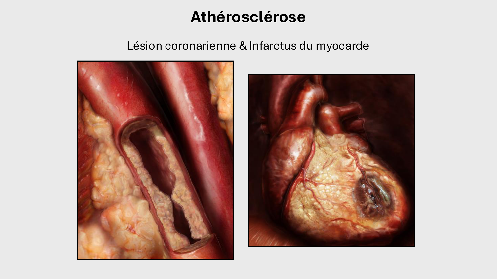 F-Mach-Cas de-liaison-Athero-1-2025 page 34