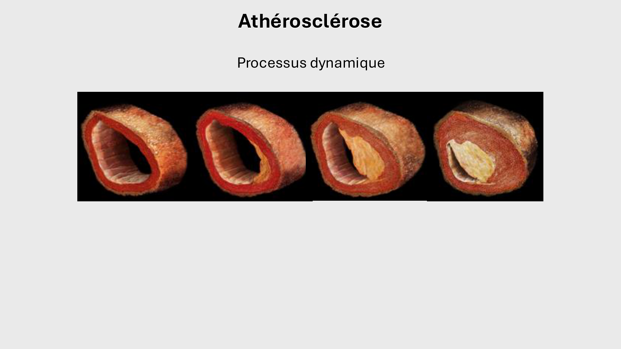 F-Mach-Cas de-liaison-Athero-1-2025 page 36