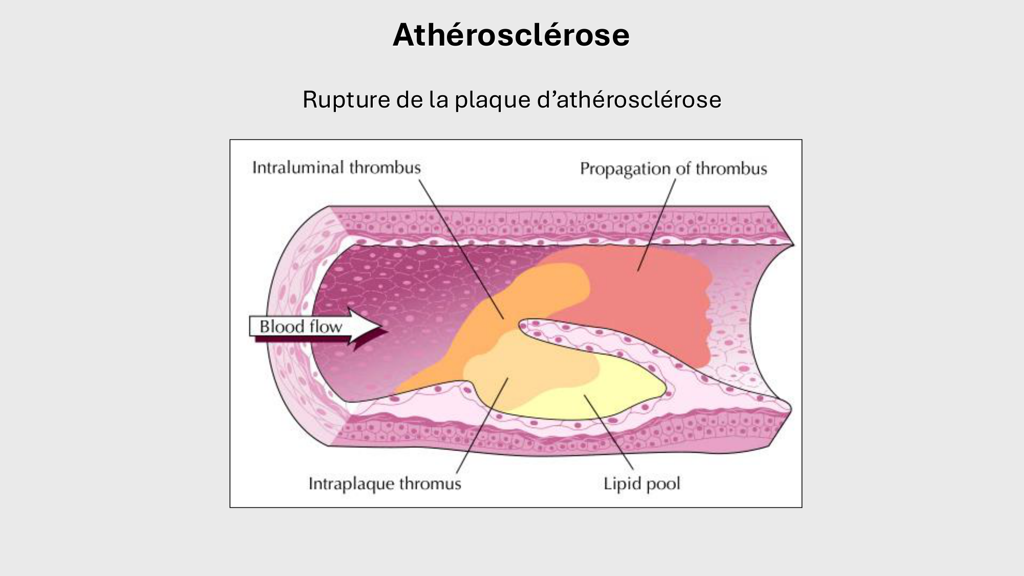 F-Mach-Cas de-liaison-Athero-1-2025 page 38