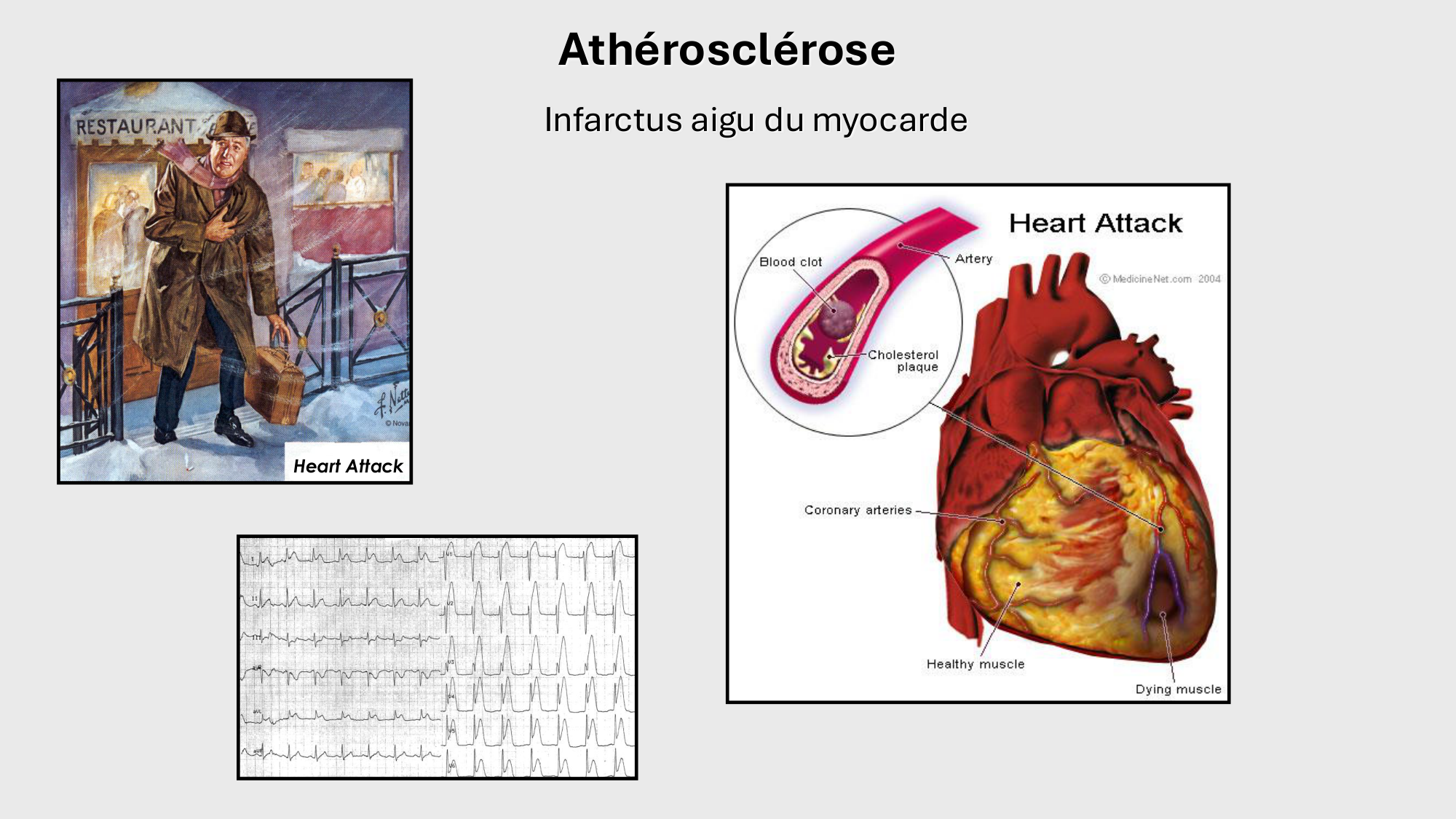 F-Mach-Cas de-liaison-Athero-1-2025 page 41