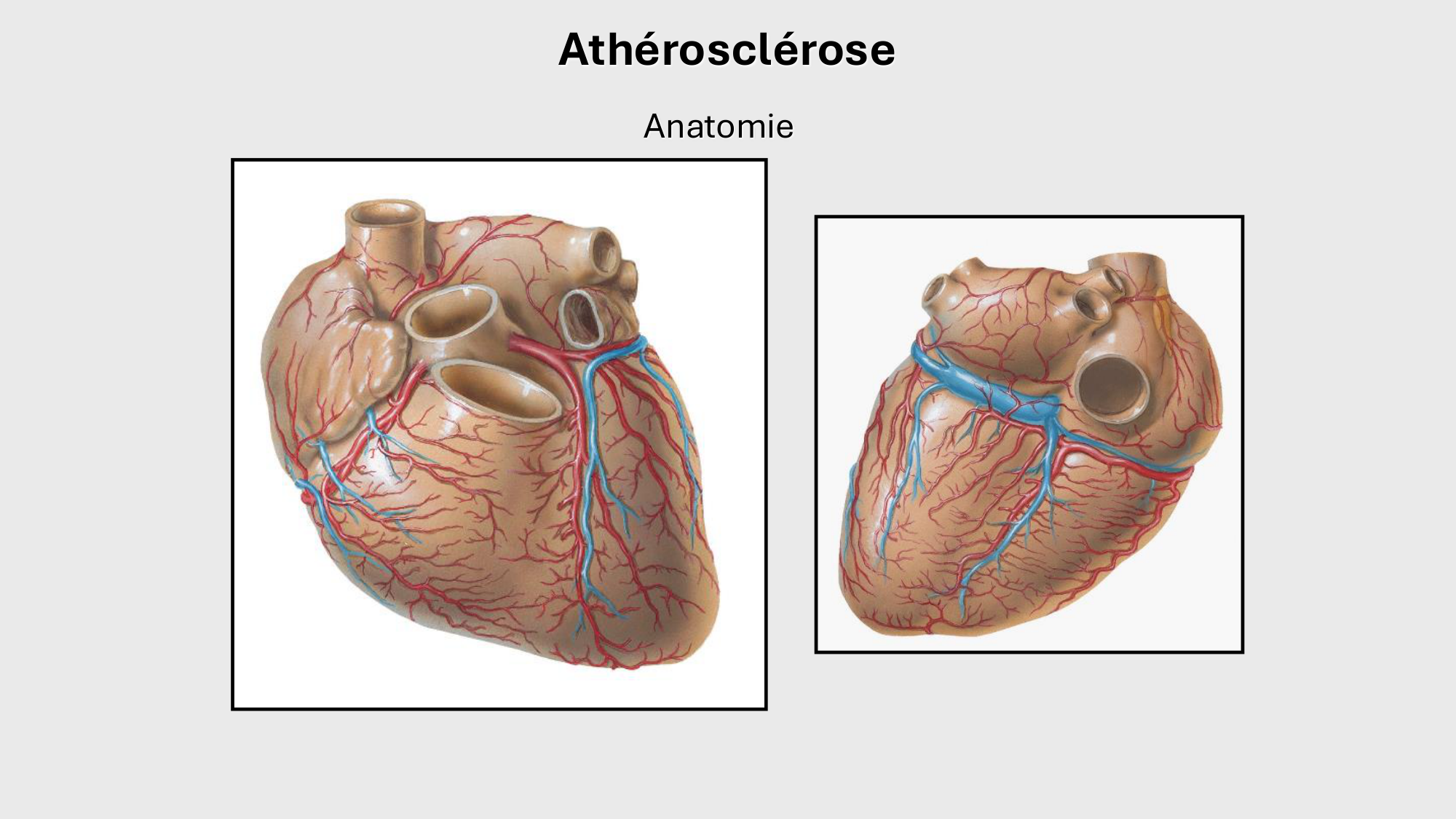 F-Mach-Cas de-liaison-Athero-1-2025 page 43