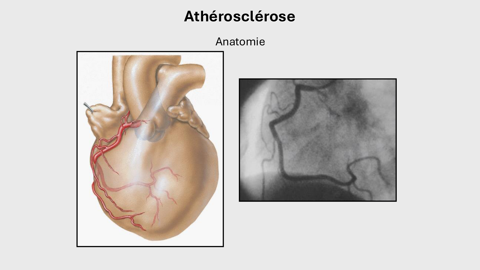 F-Mach-Cas de-liaison-Athero-1-2025 page 44