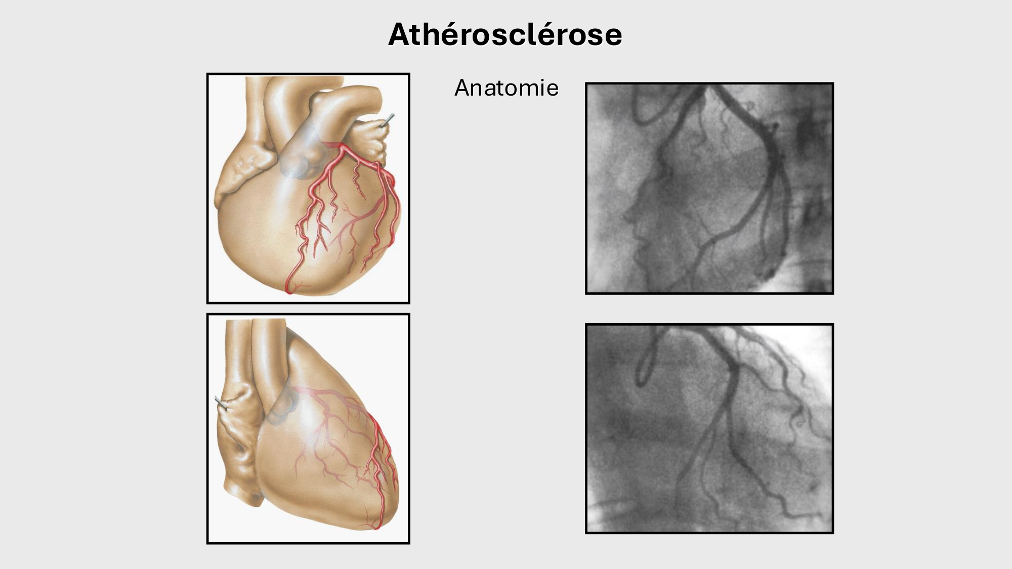 F-Mach-Cas de-liaison-Athero-1-2025 page 45