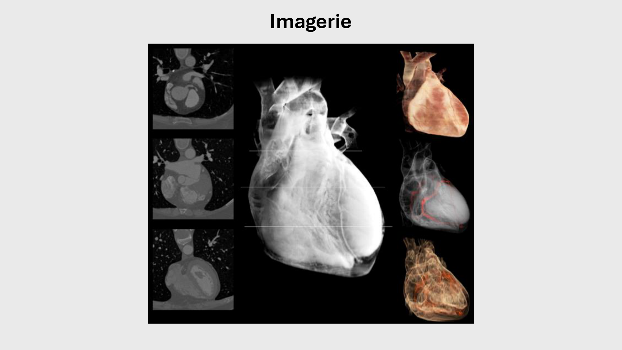 F-Mach-Cas de-liaison-Athero-1-2025 page 46