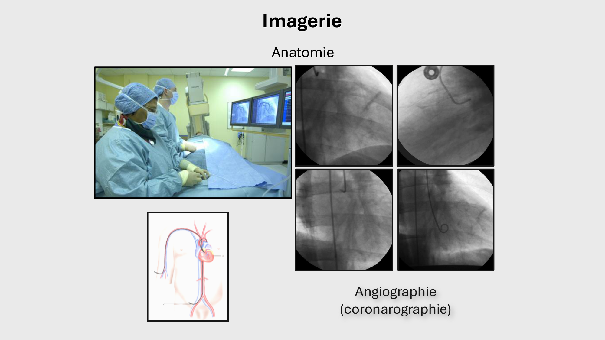 F-Mach-Cas de-liaison-Athero-1-2025 page 47