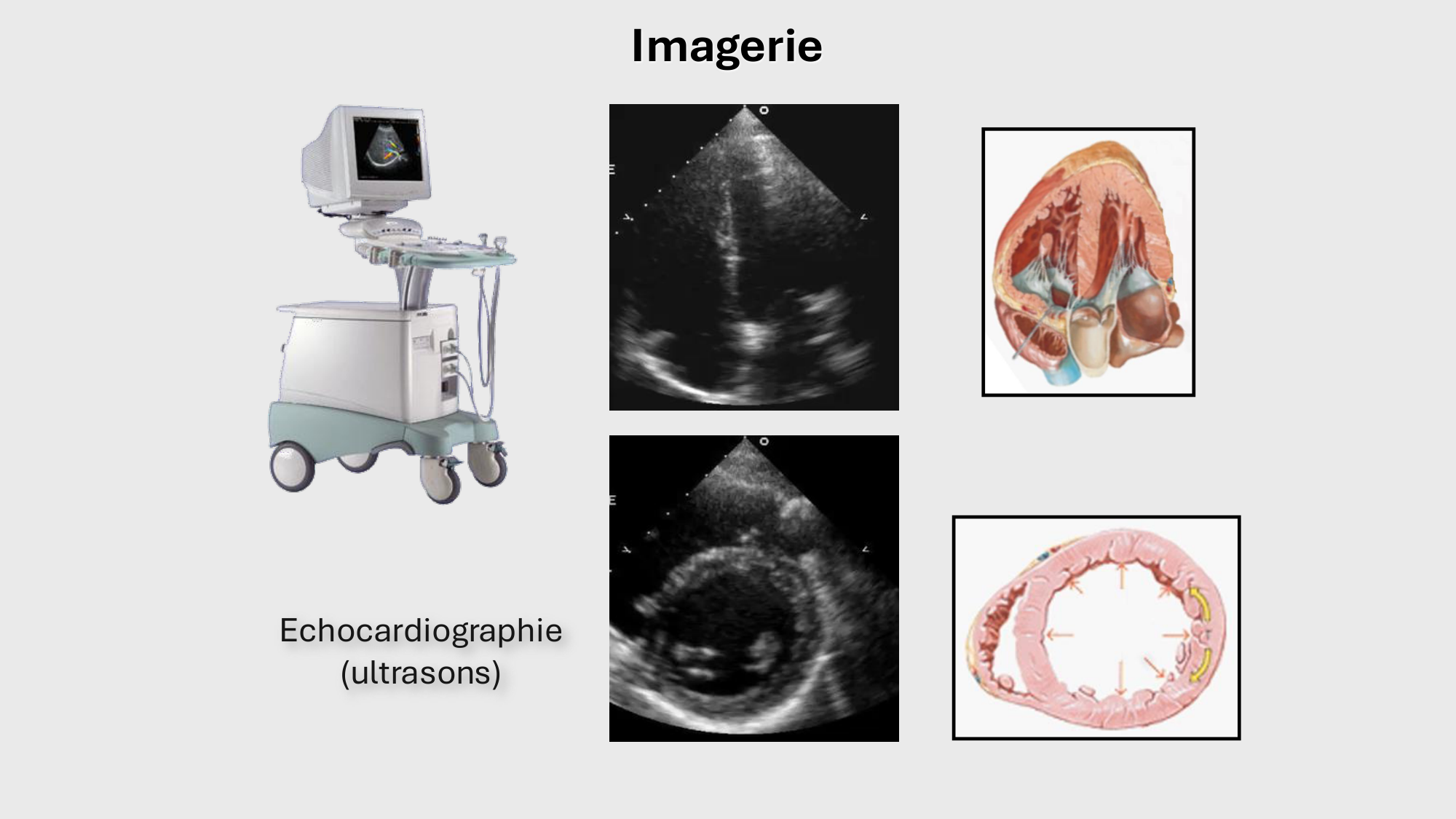 F-Mach-Cas de-liaison-Athero-1-2025 page 48