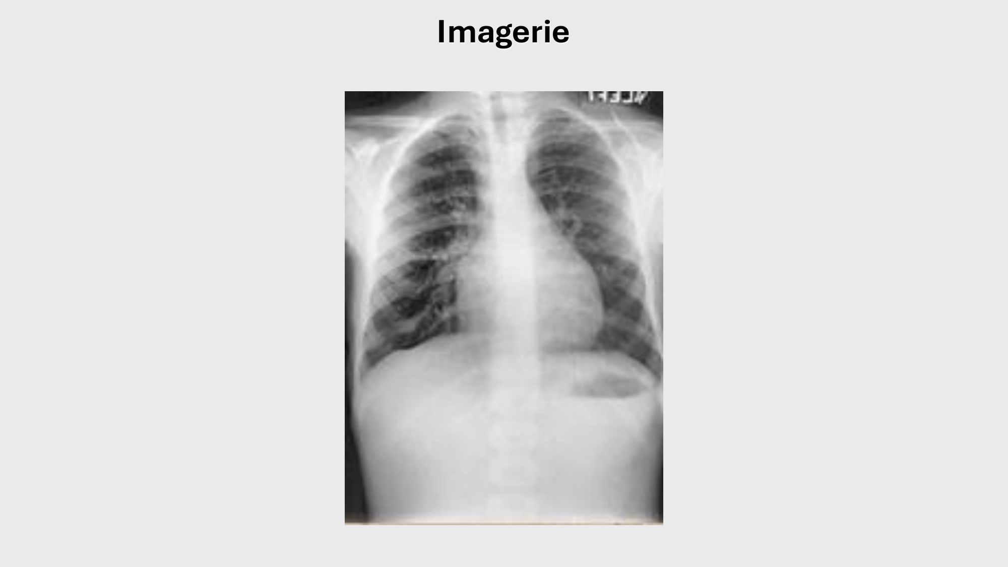 F-Mach-Cas de-liaison-Athero-1-2025 page 49