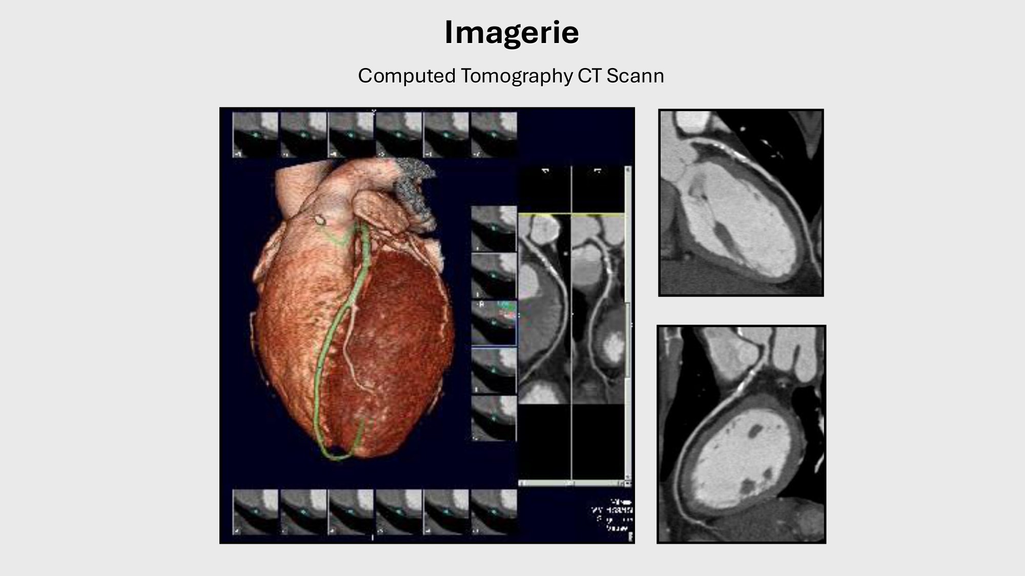 F-Mach-Cas de-liaison-Athero-1-2025 page 51