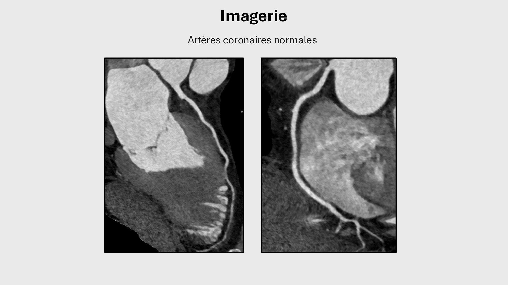 F-Mach-Cas de-liaison-Athero-1-2025 page 52