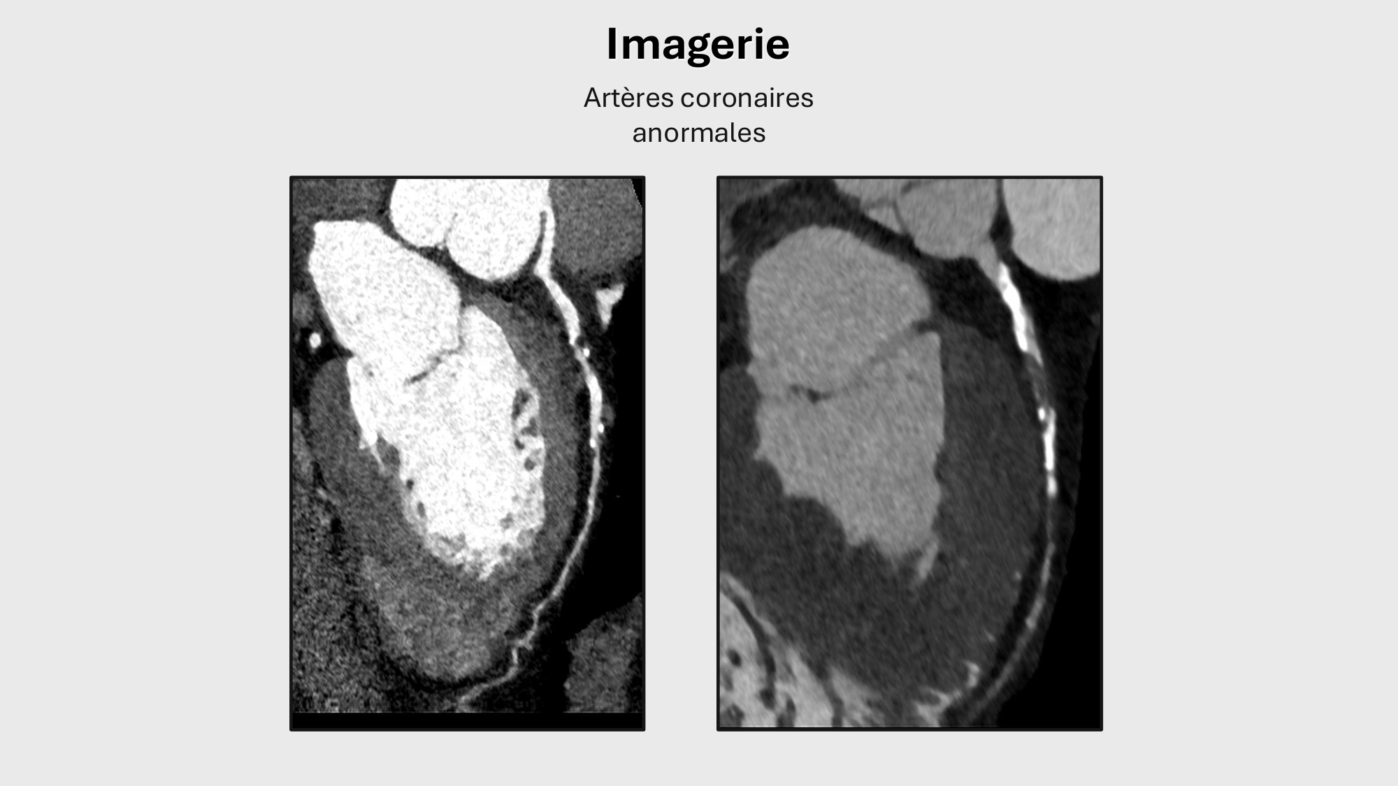 F-Mach-Cas de-liaison-Athero-1-2025 page 53