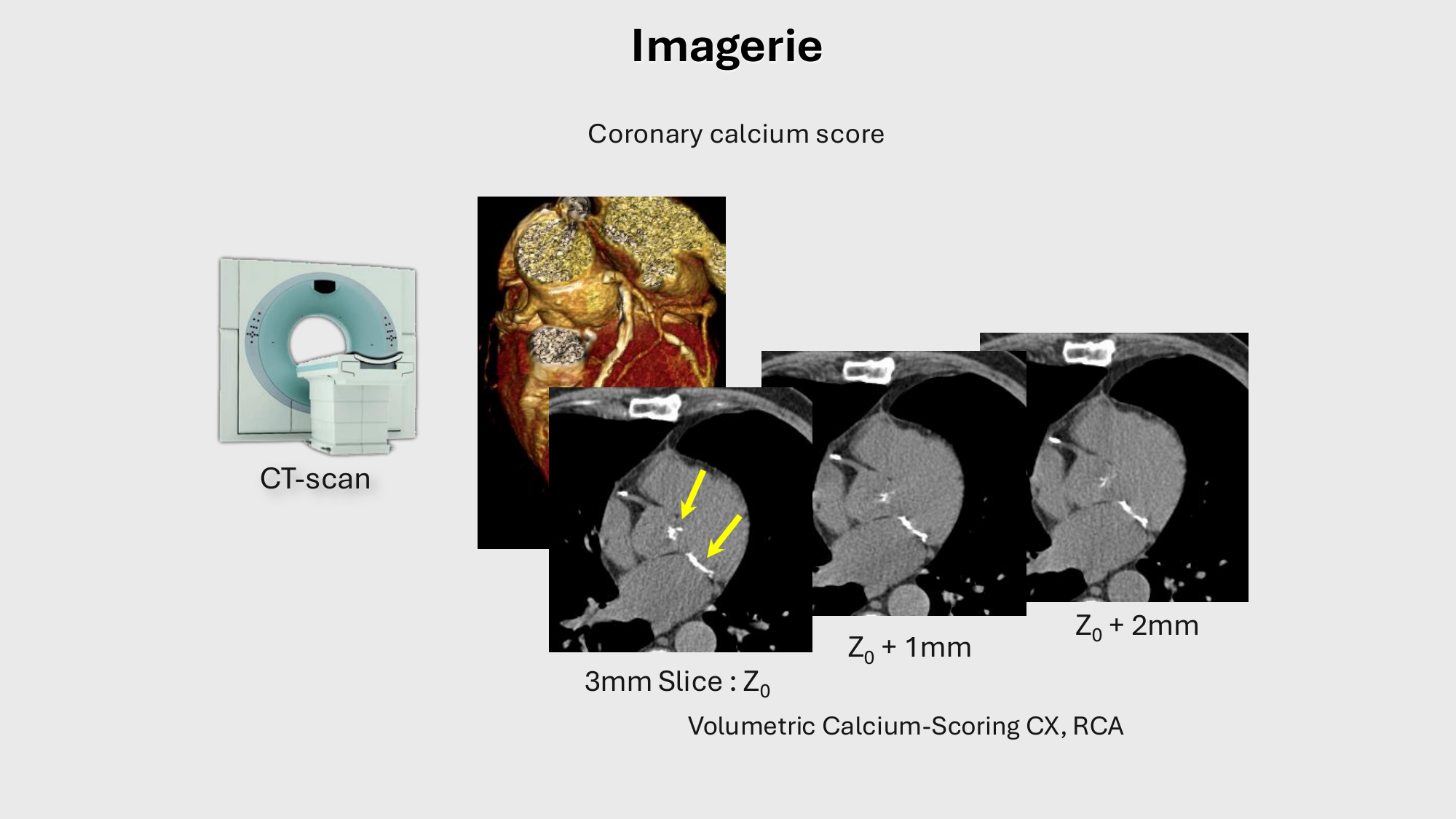 F-Mach-Cas de-liaison-Athero-1-2025 page 54