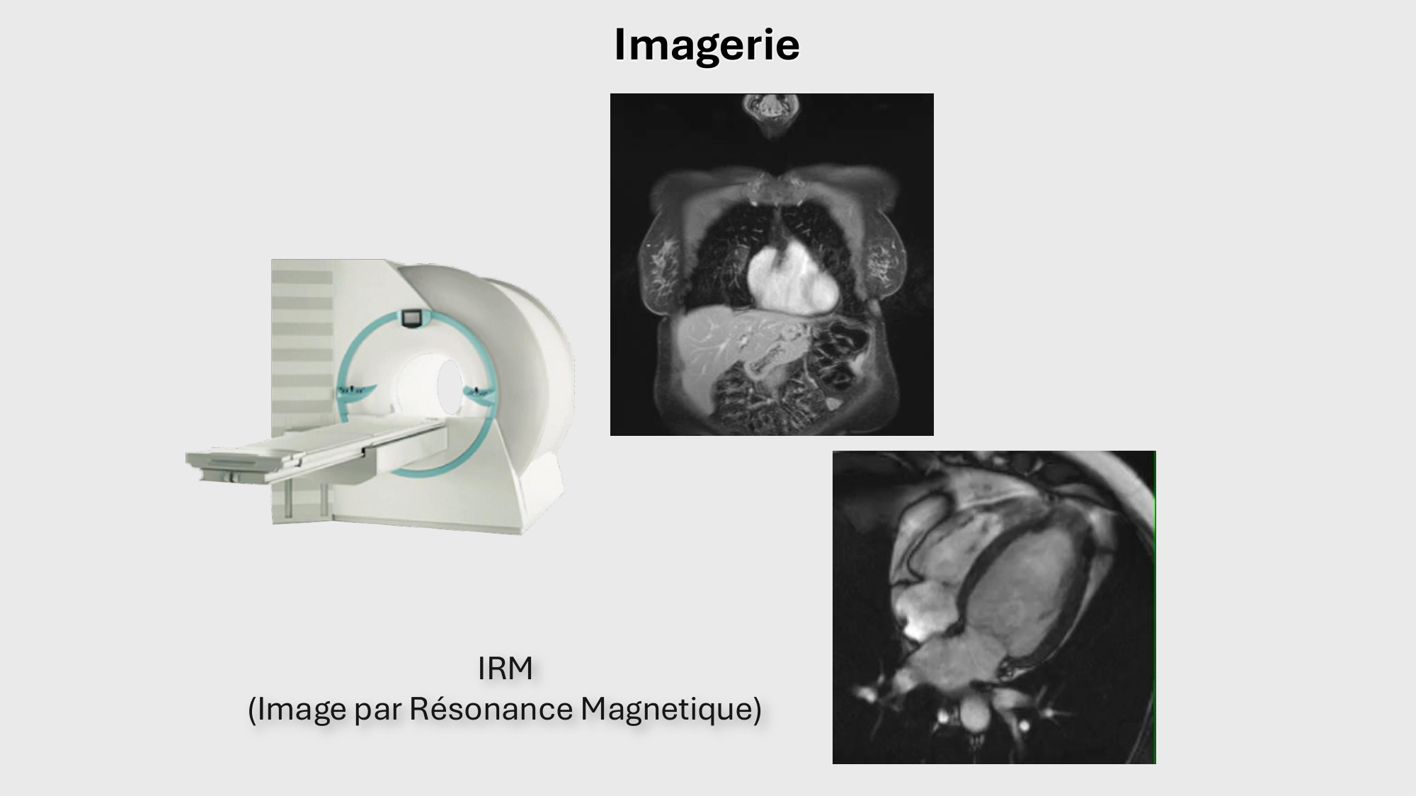 F-Mach-Cas de-liaison-Athero-1-2025 page 55