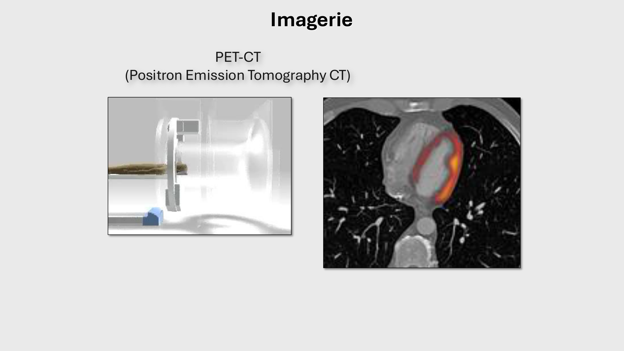 F-Mach-Cas de-liaison-Athero-1-2025 page 56
