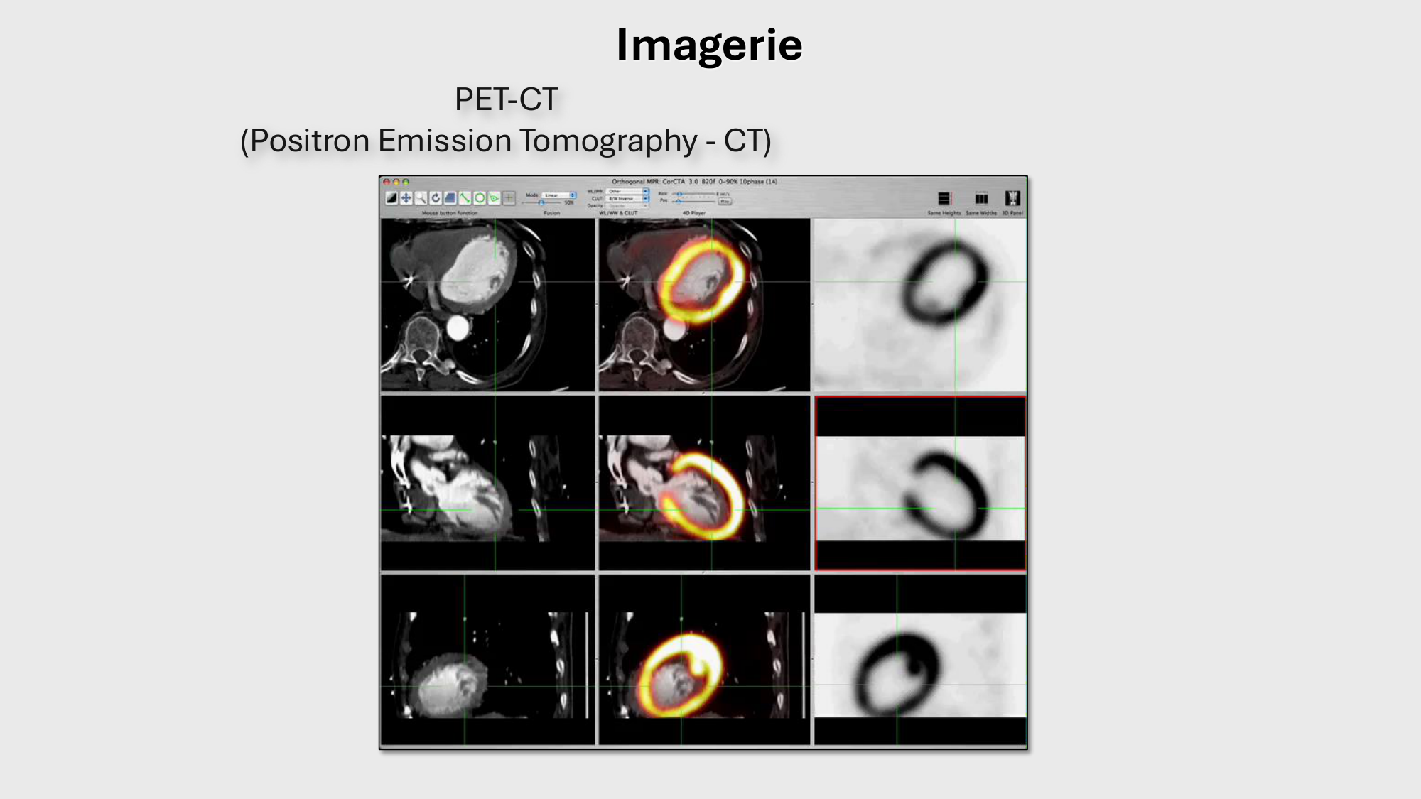 F-Mach-Cas de-liaison-Athero-1-2025 page 57