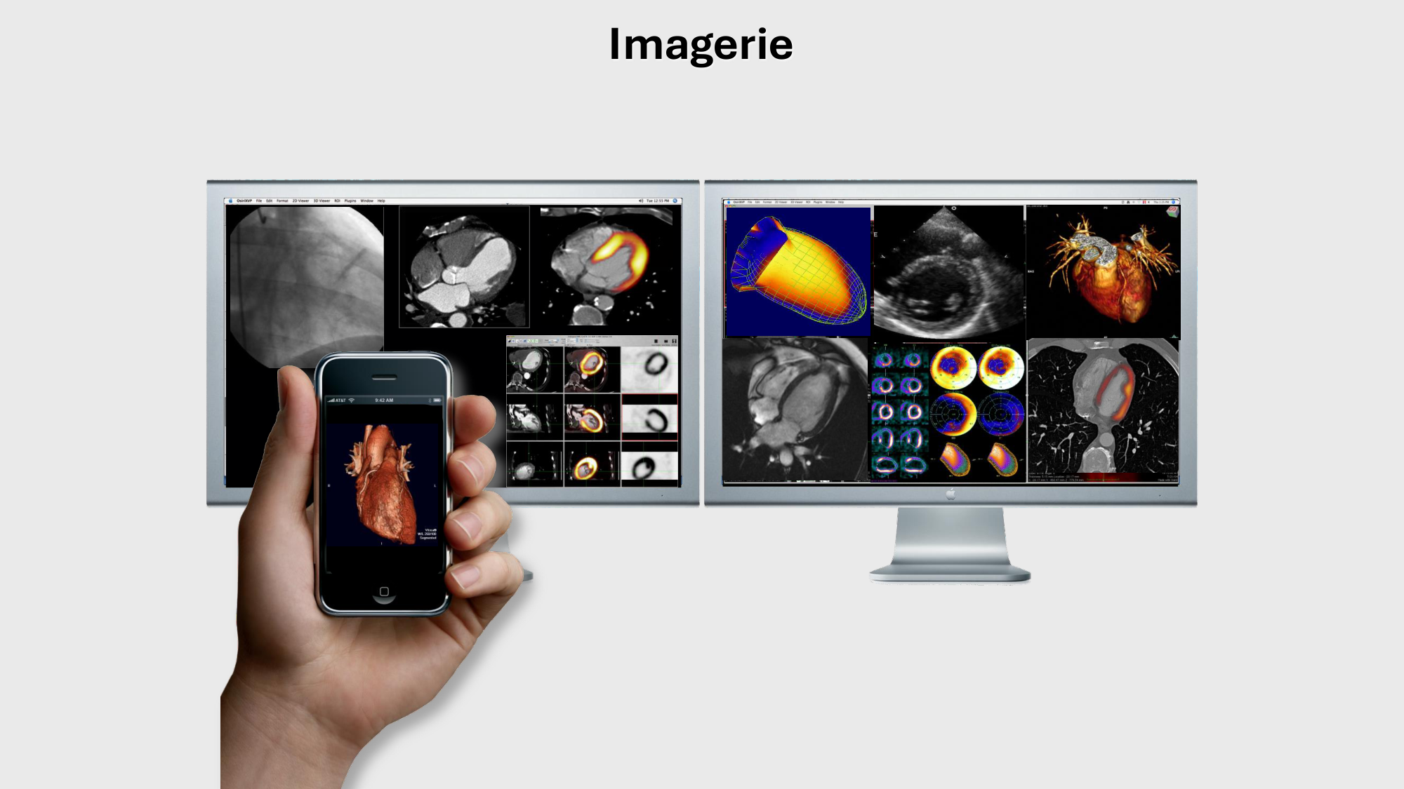 F-Mach-Cas de-liaison-Athero-1-2025 page 58