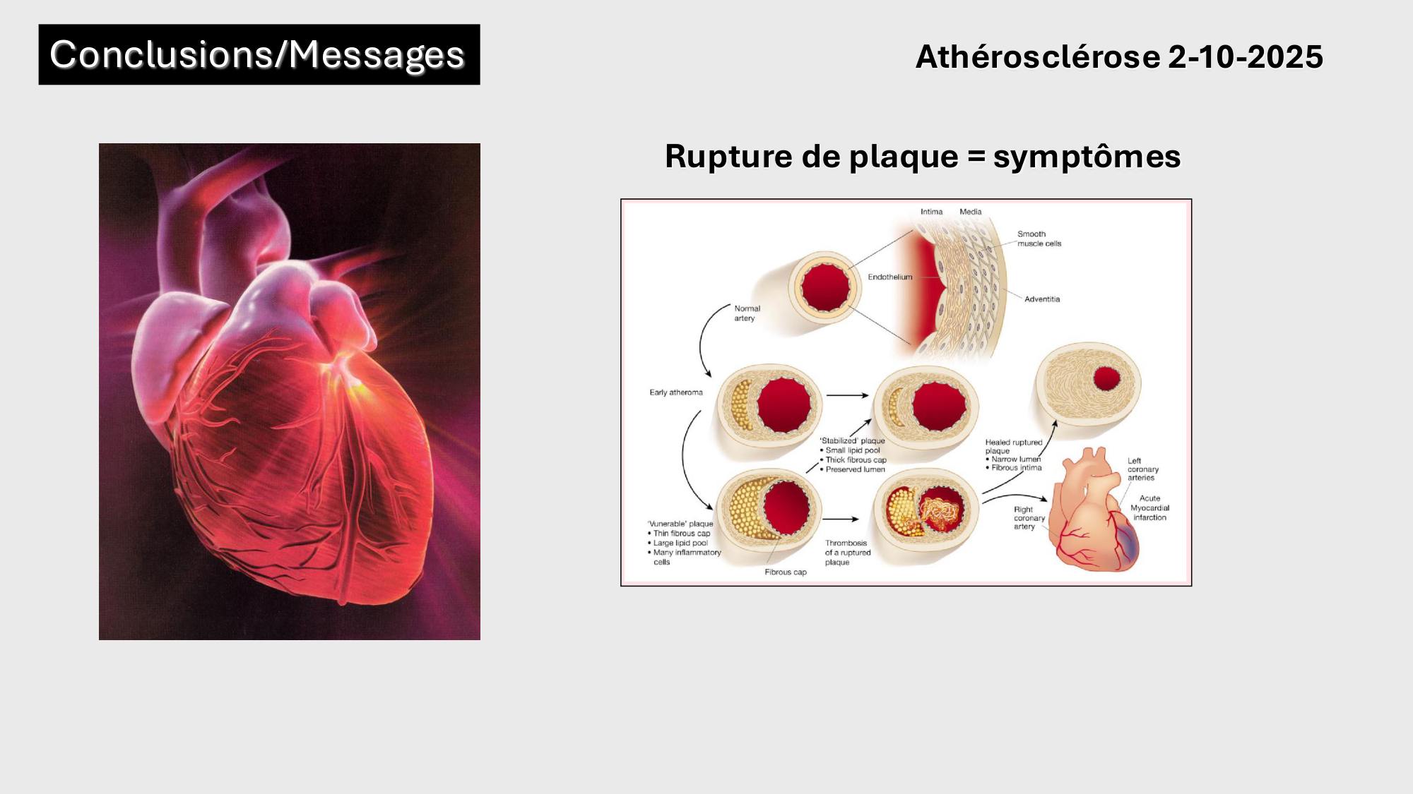 F-Mach-Cas de-liaison-Athero-1-2025 page 61
