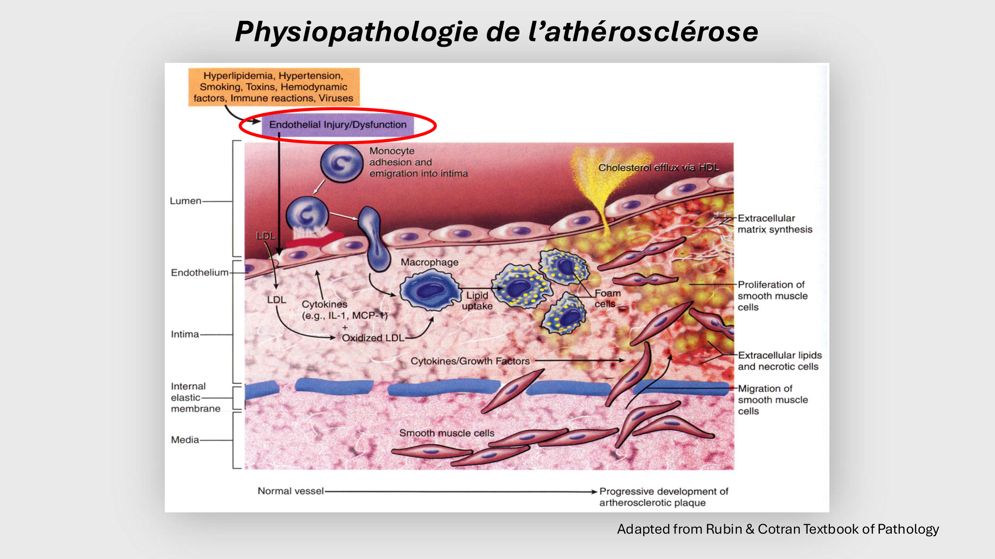 F-Mach-Cas de-liaison-Athero-2-2025 page 36