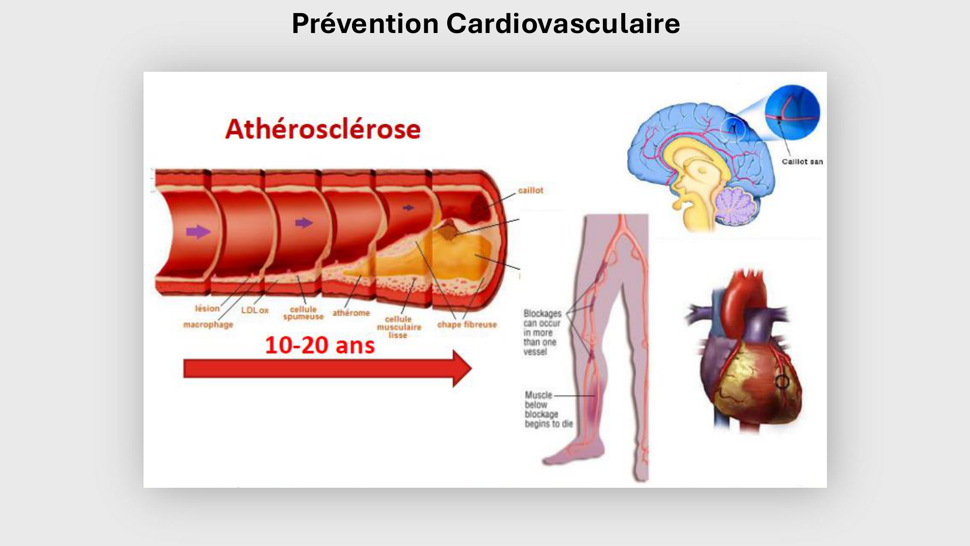 F-Mach-Cas de-liaison-Athero-3-19.11.2025 page 2