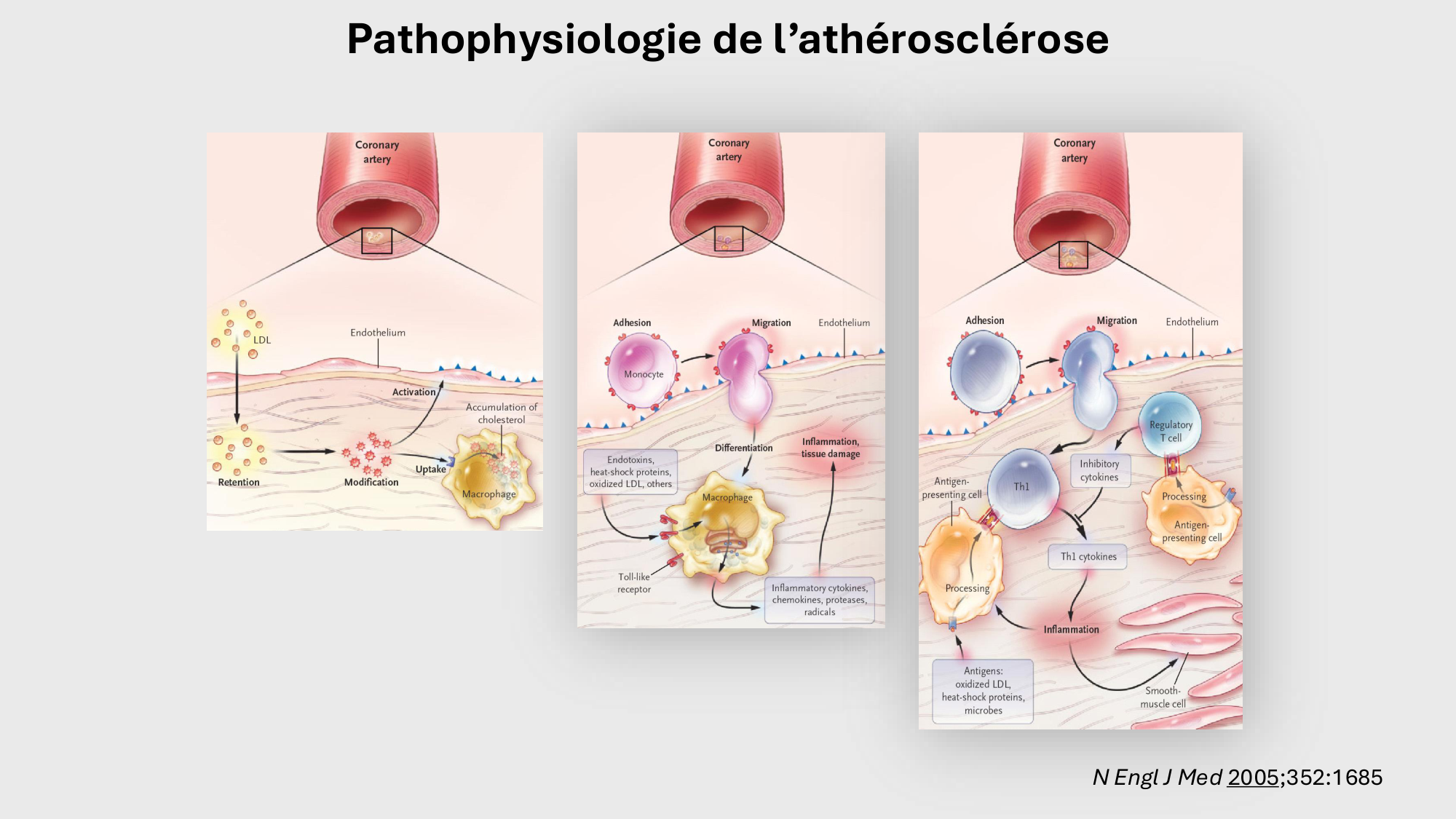F-Mach-Cas de-liaison-Athero-3-19.11.2025 page 29