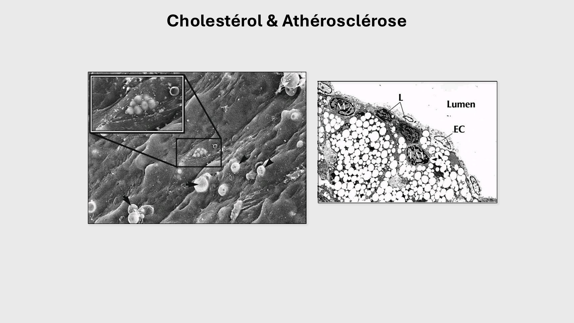 F-Mach-Cas de-liaison-Athero-3-19.11.2025 page 49