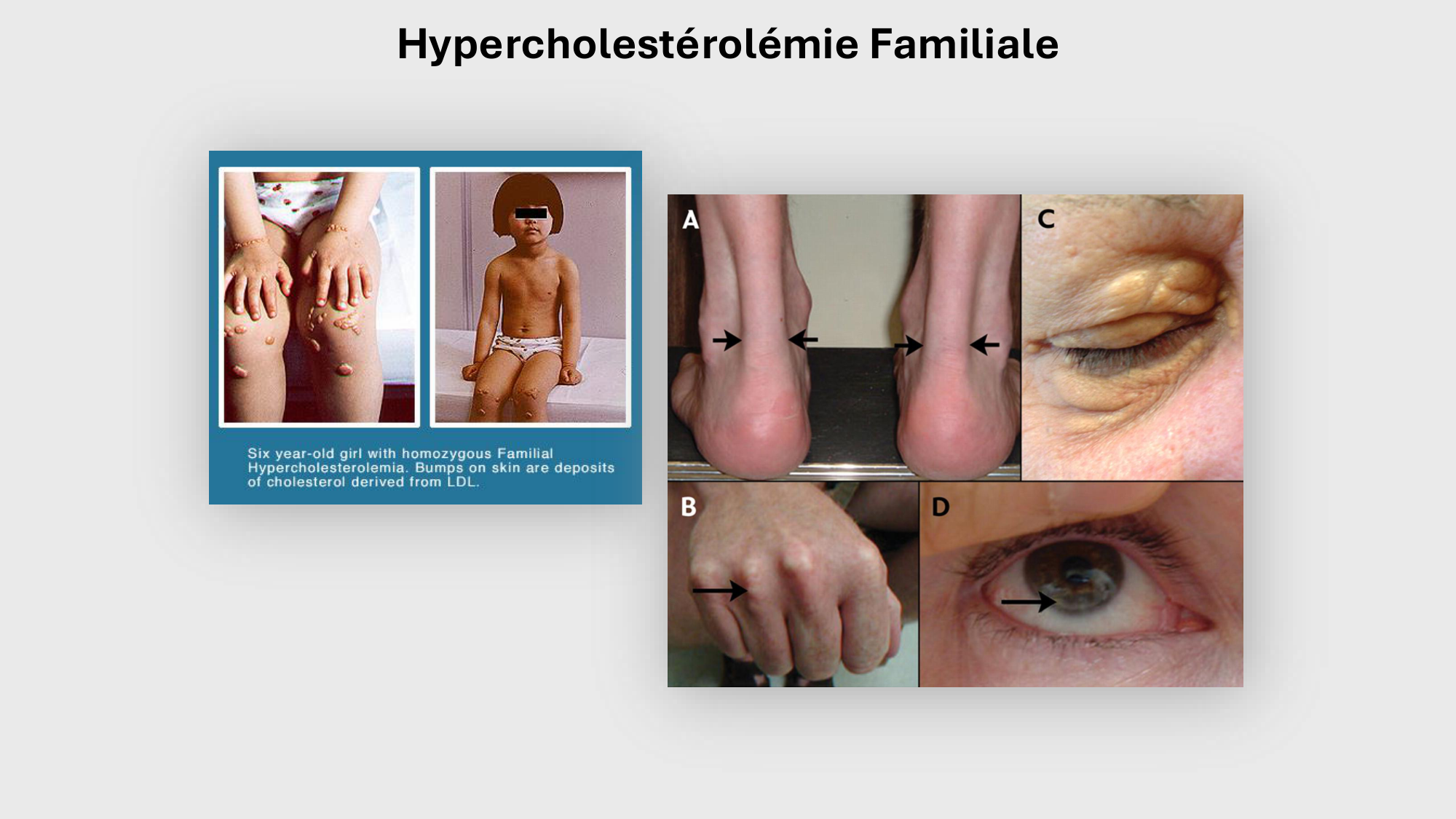 F-Mach-Cas de-liaison-Athero-4-11.12.2025 page 12