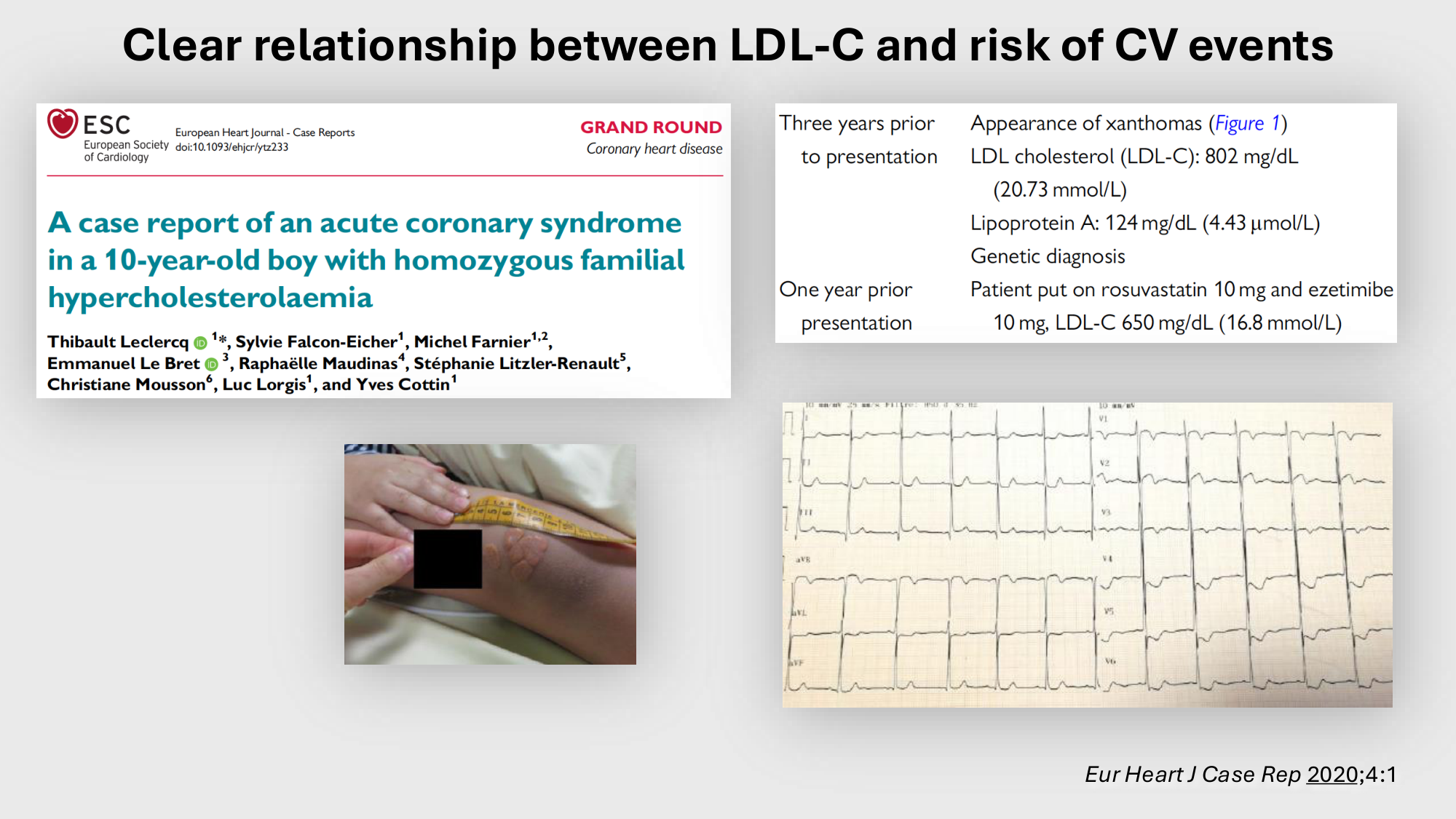 F-Mach-Cas de-liaison-Athero-4-11.12.2025 page 13