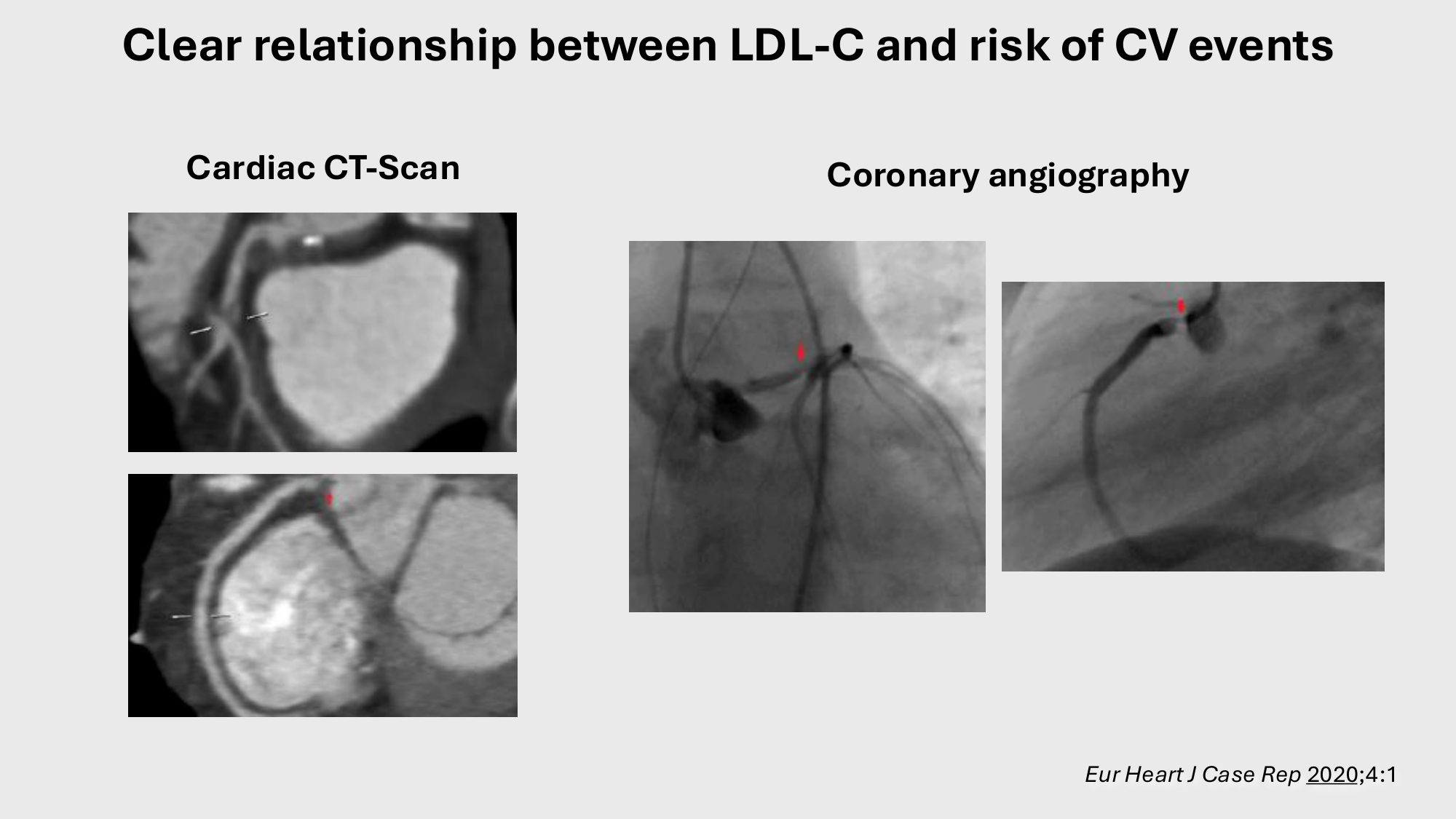 F-Mach-Cas de-liaison-Athero-4-11.12.2025 page 14
