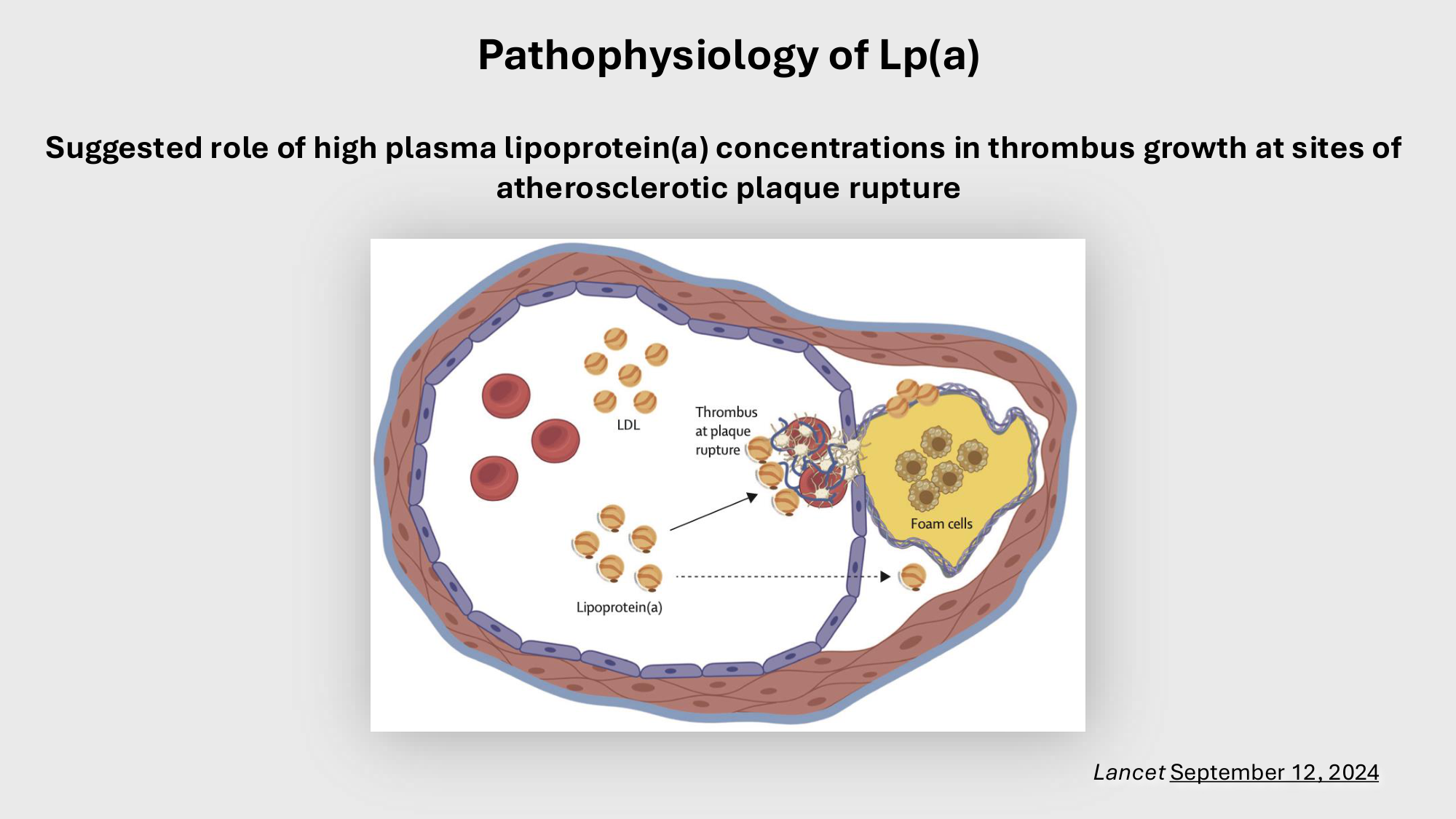 F-Mach-Cas de-liaison-Athero-4-11.12.2025 page 34