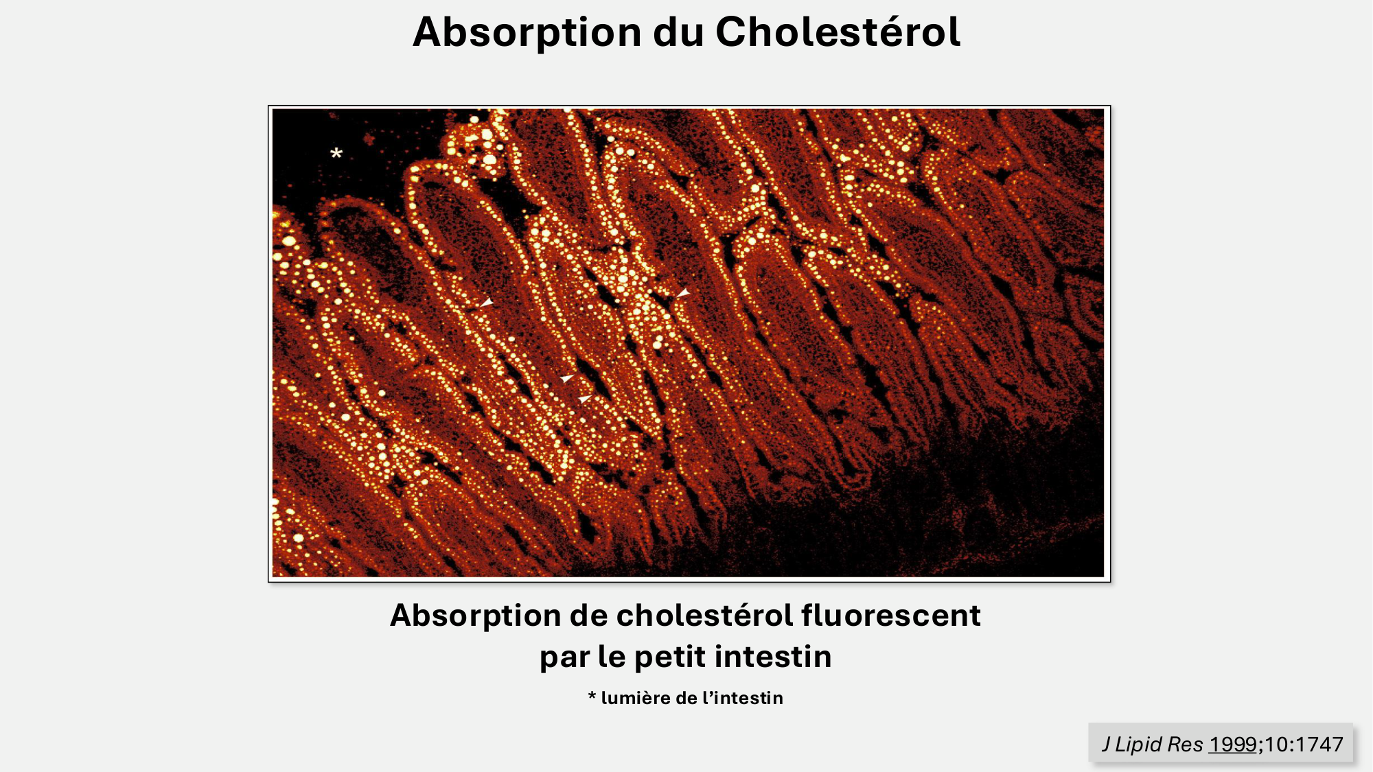 F-Mach-Cas de-liaison-Athero-5-12.1.2026 page 30