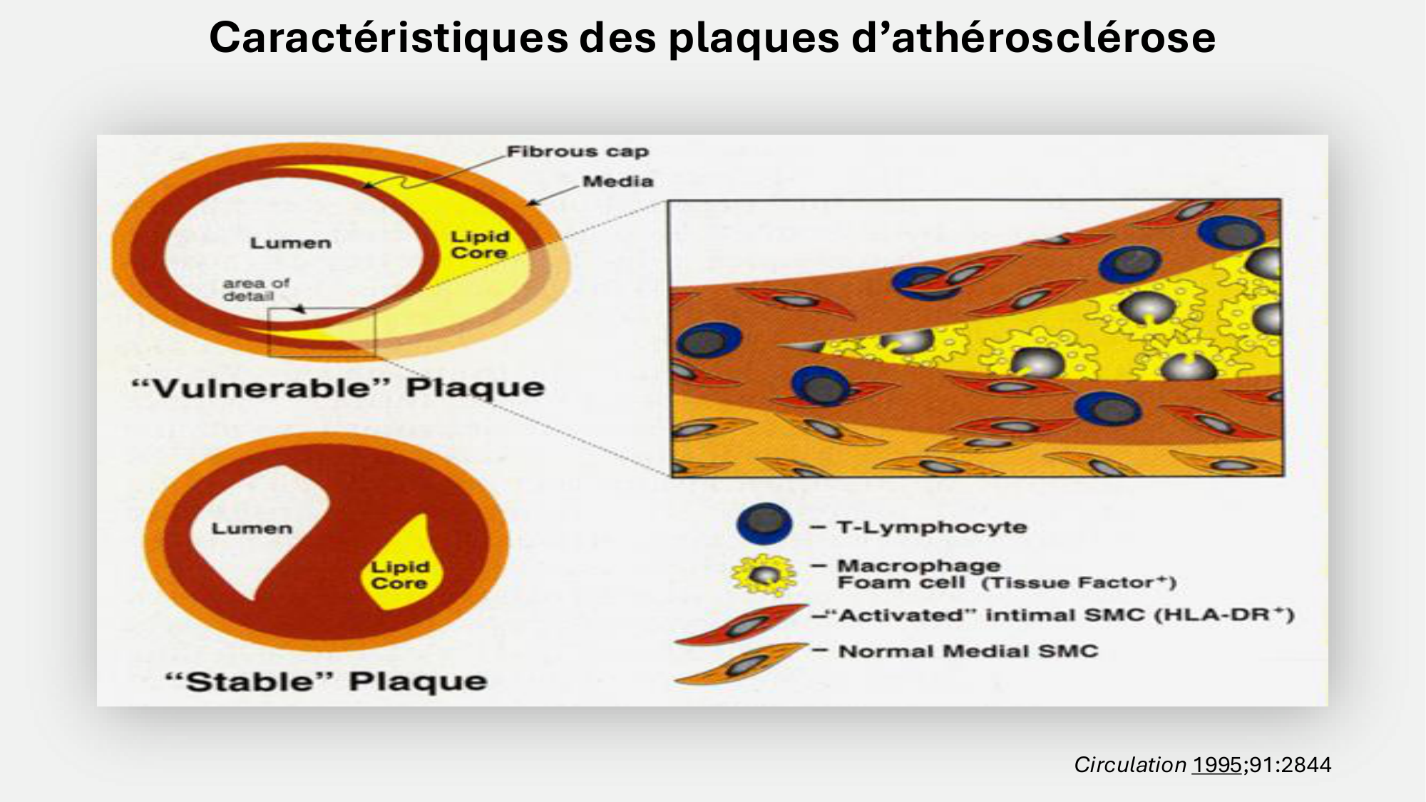 F-Mach-Cas de-liaison-Athero-6-29.1.2026.pdf page 8