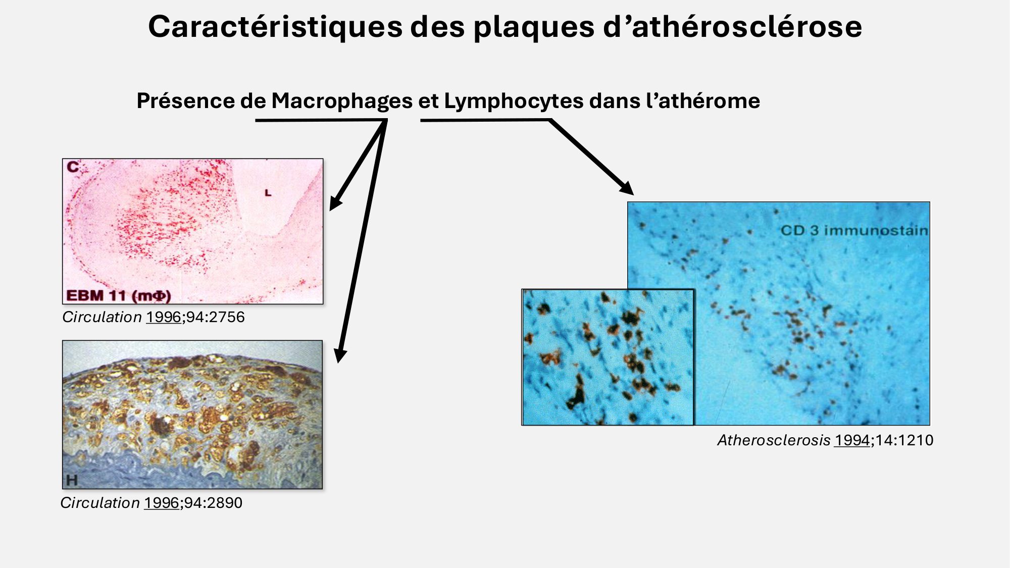 F-Mach-Cas de-liaison-Athero-6-29.1.2026.pdf page 9