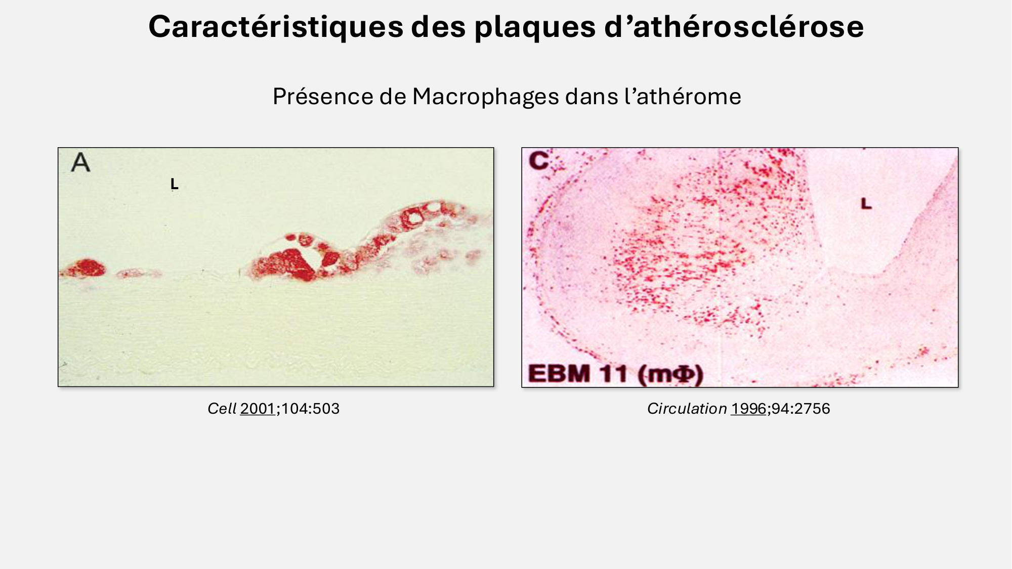 F-Mach-Cas de-liaison-Athero-6-29.1.2026.pdf page 10
