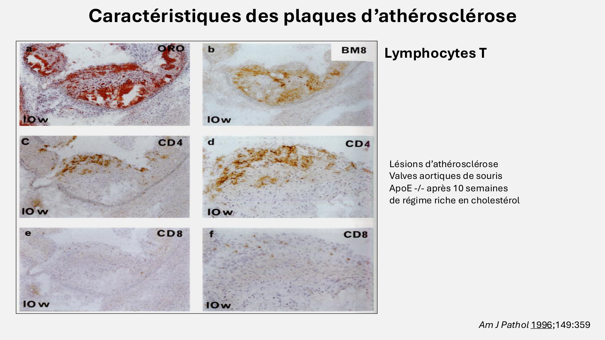 F-Mach-Cas de-liaison-Athero-6-29.1.2026.pdf page 11
