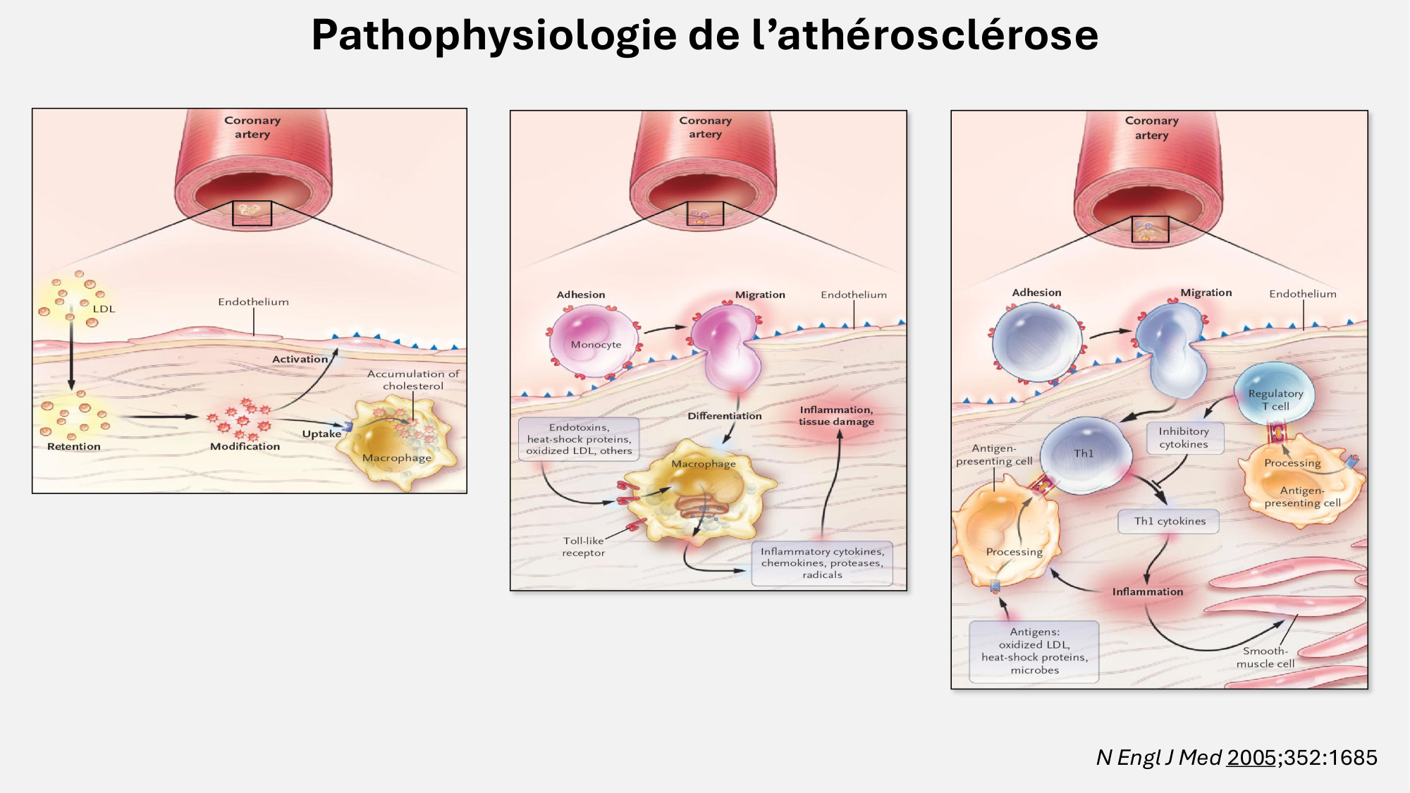 F-Mach-Cas de-liaison-Athero-6-29.1.2026.pdf page 17